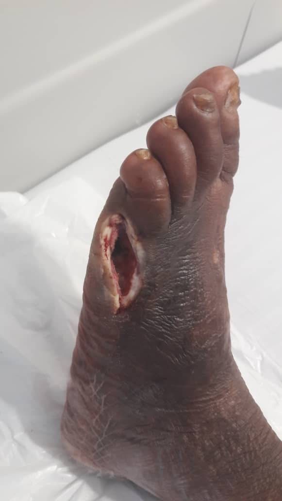 Please Help Save OurMum’s Life & Leg – Urgent Medical Care N campaign photo, 2 of 8
