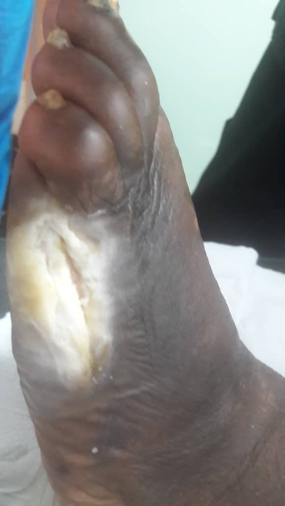 Please Help Save OurMum’s Life & Leg – Urgent Medical Care N campaign photo, 4 of 8