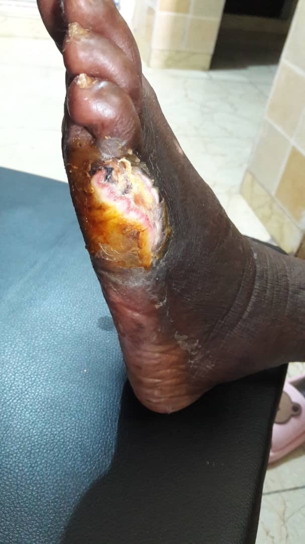 Please Help Save OurMum’s Life & Leg – Urgent Medical Care N campaign photo, 5 of 8