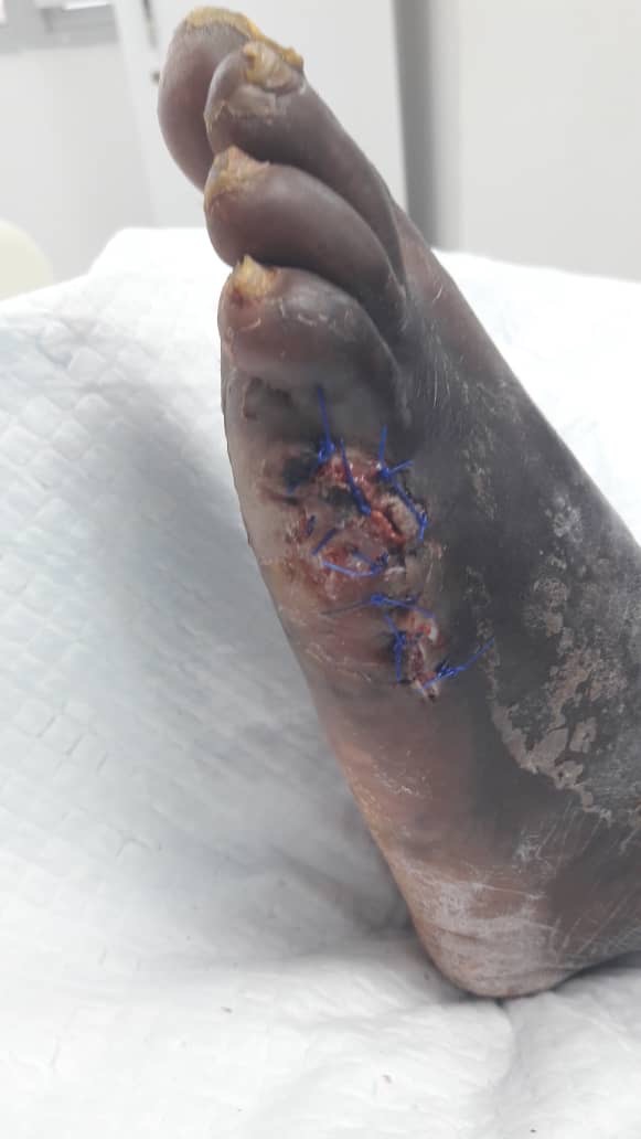 Please Help Save OurMum’s Life & Leg – Urgent Medical Care N campaign photo, 6 of 8