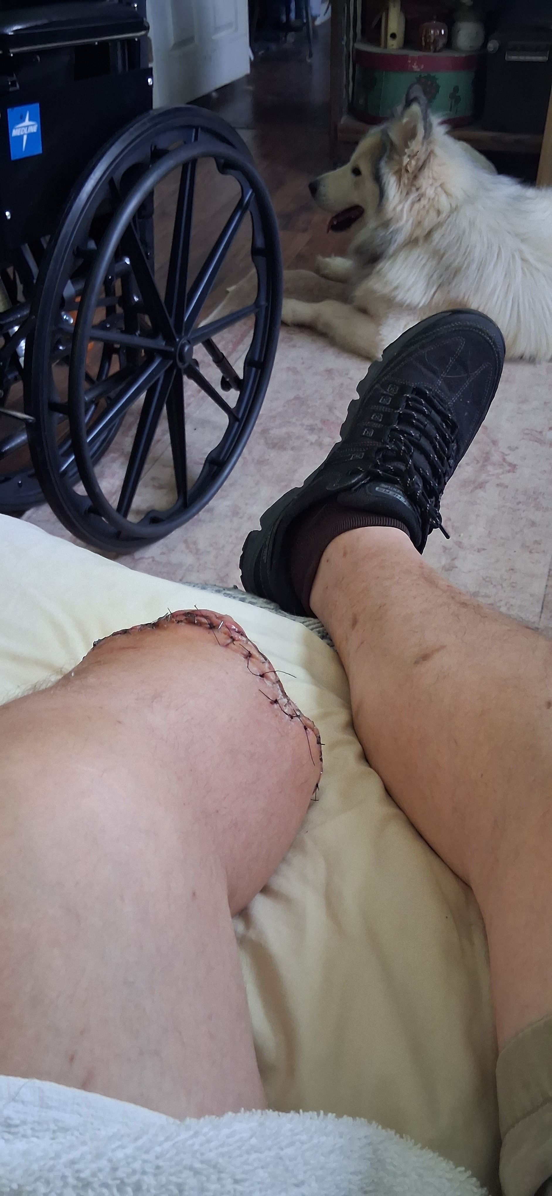 Support Anthony Puryear's Recovery Journey campaign photo, 2 of 5