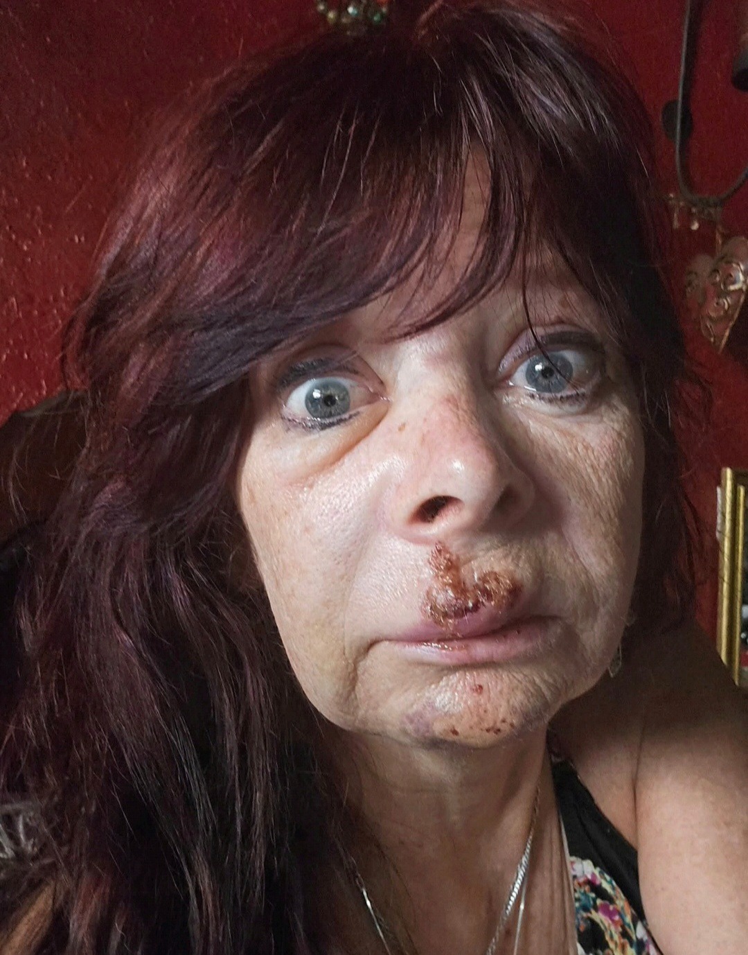 Help Support Diana's Dental Expense From Blunt Force Trauma campaign photo, 2 of 8