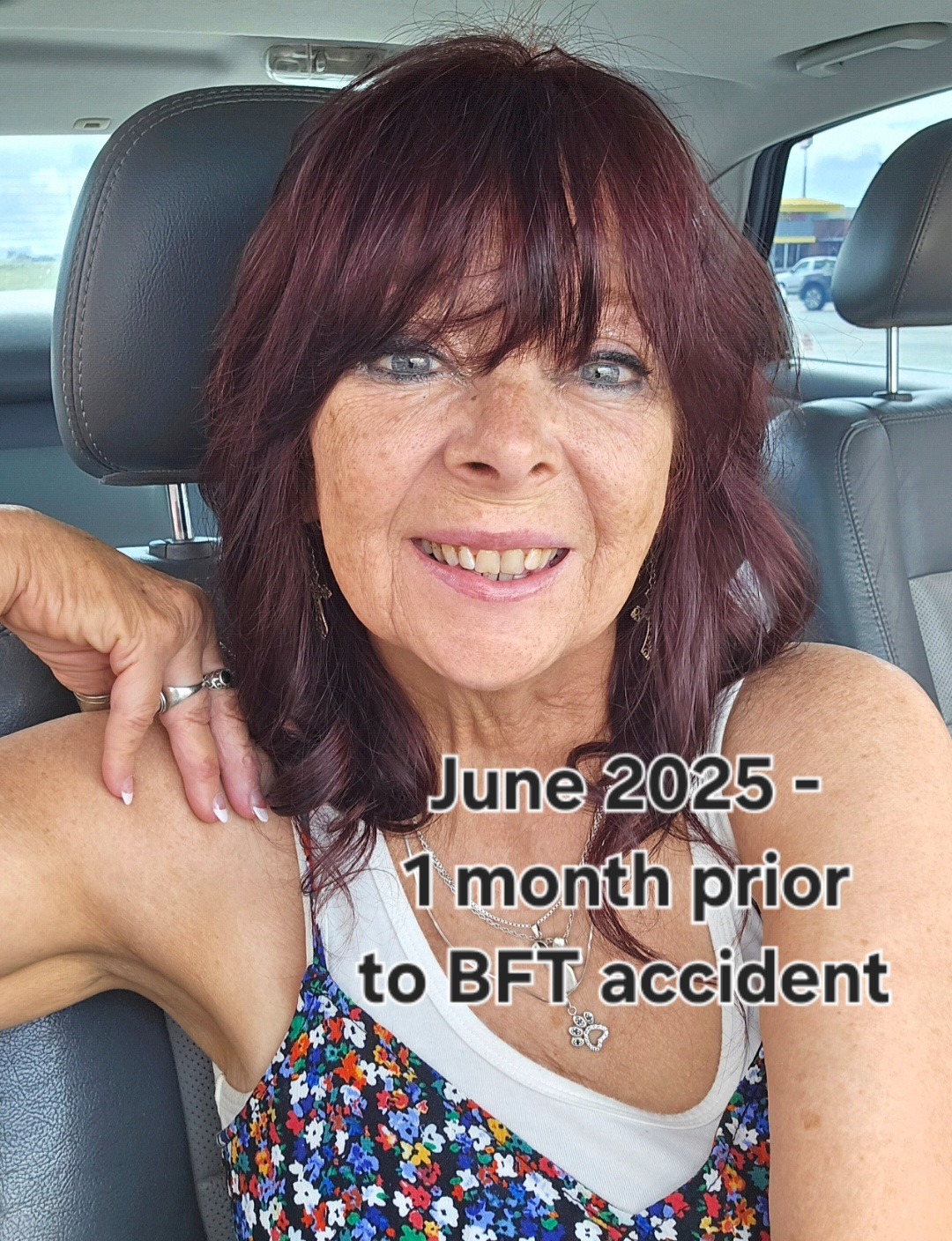 Help Support Diana's Dental Expense From Blunt Force Trauma campaign photo, 6 of 8