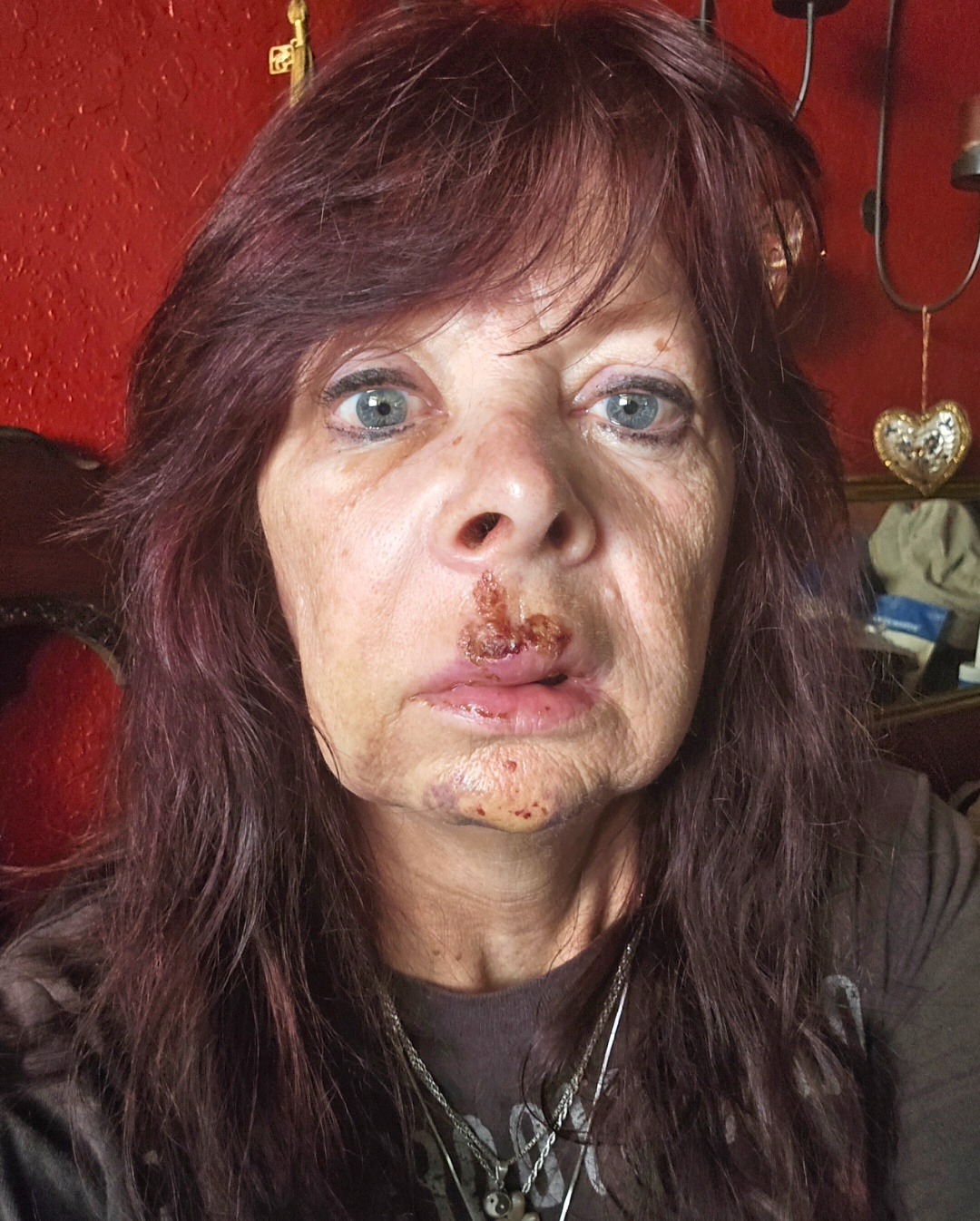 Help Support Diana's Dental Expense From Blunt Force Trauma campaign photo, 4 of 8