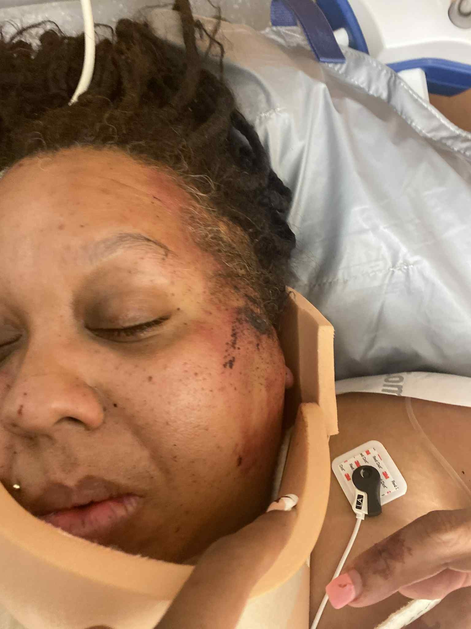 Donate to Help Christy Recover from a Car Crash campaign photo, 4 of 6