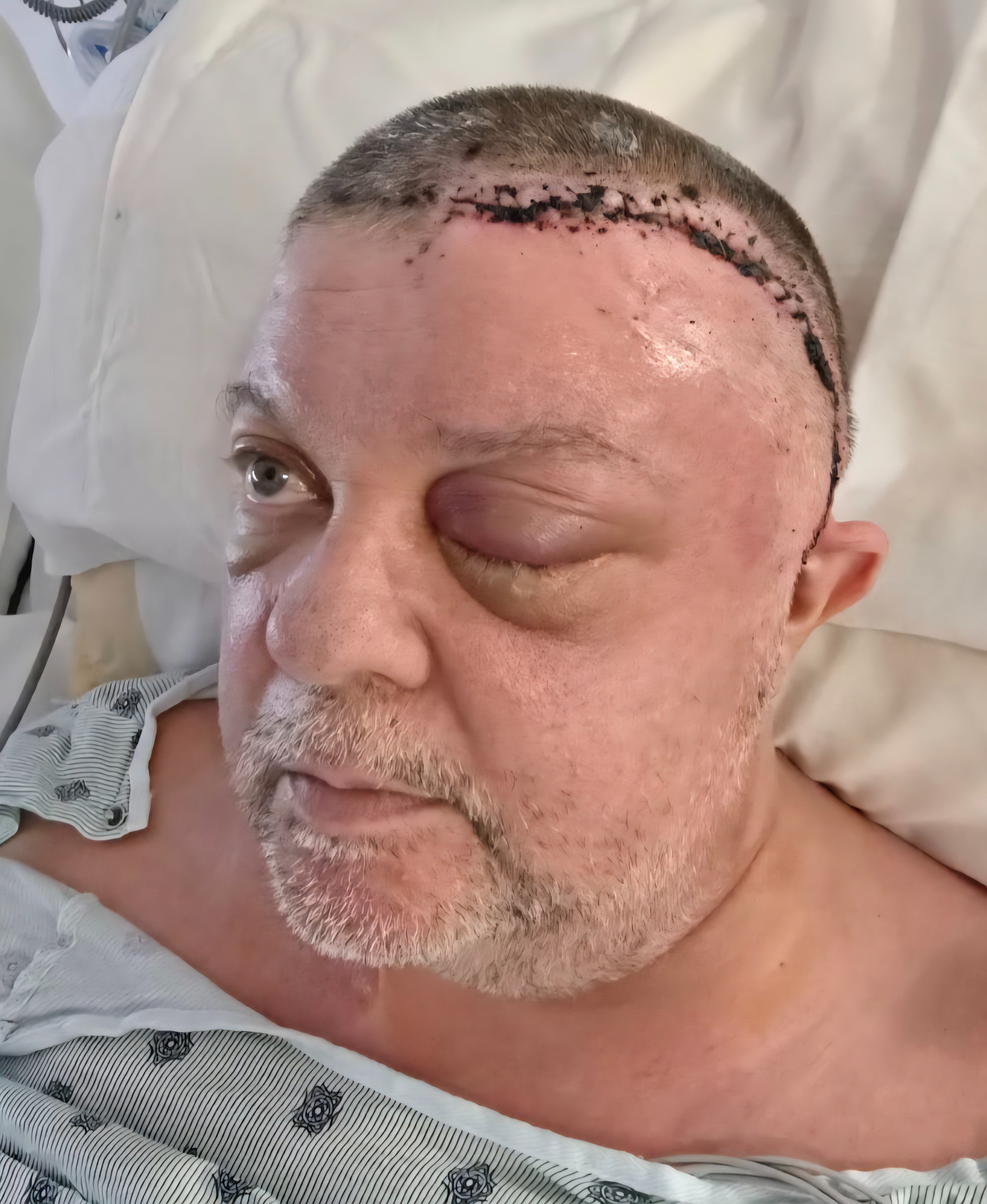 Help Support Bob & Stacy: 2 Surgeries, 1 Big Recovery campaign photo, 6 of 7