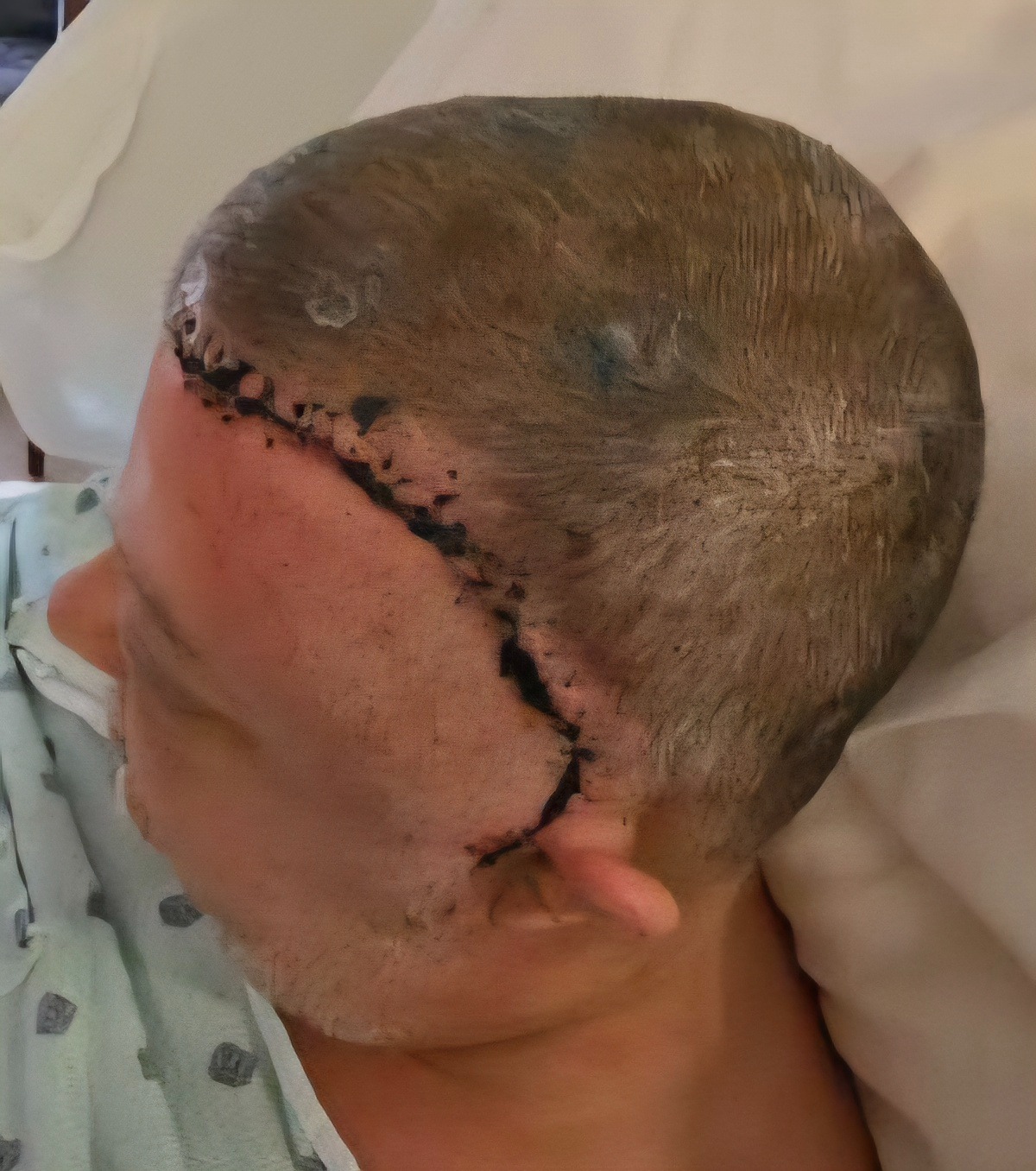 Help Support Bob & Stacy: 2 Surgeries, 1 Big Recovery campaign photo, 2 of 7