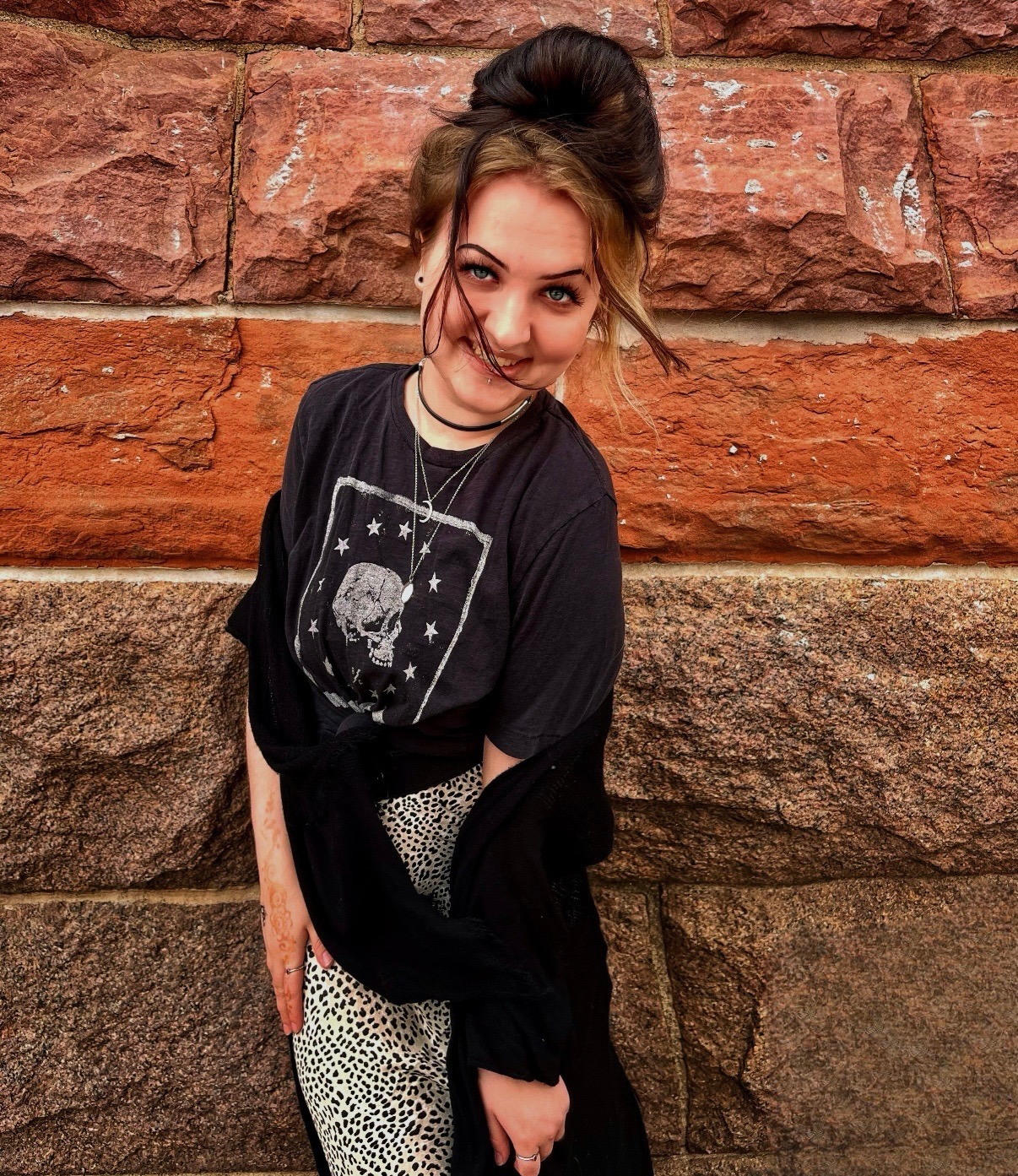 Help support Eva through surgery and recovery campaign photo, 6 of 7