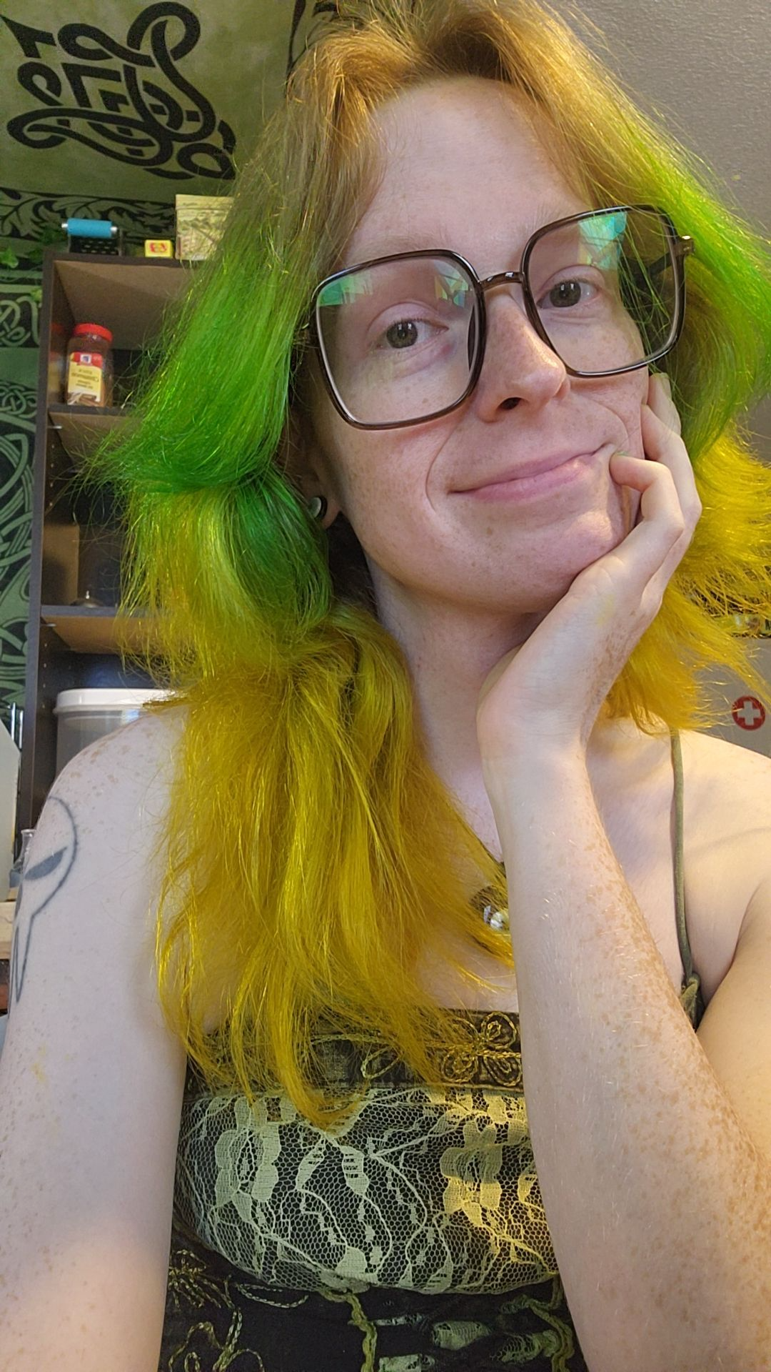 Donate to Sunflower's Transition Journey campaign photo, 4 of 7