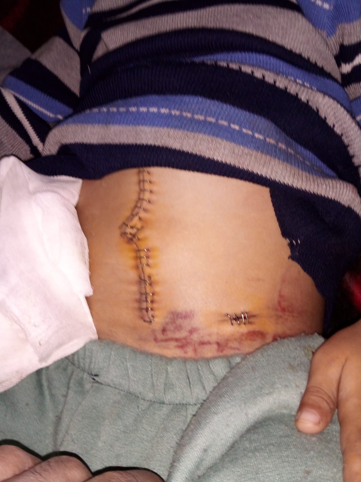 Help Niveen and her family survive campaign photo, 2 of 6