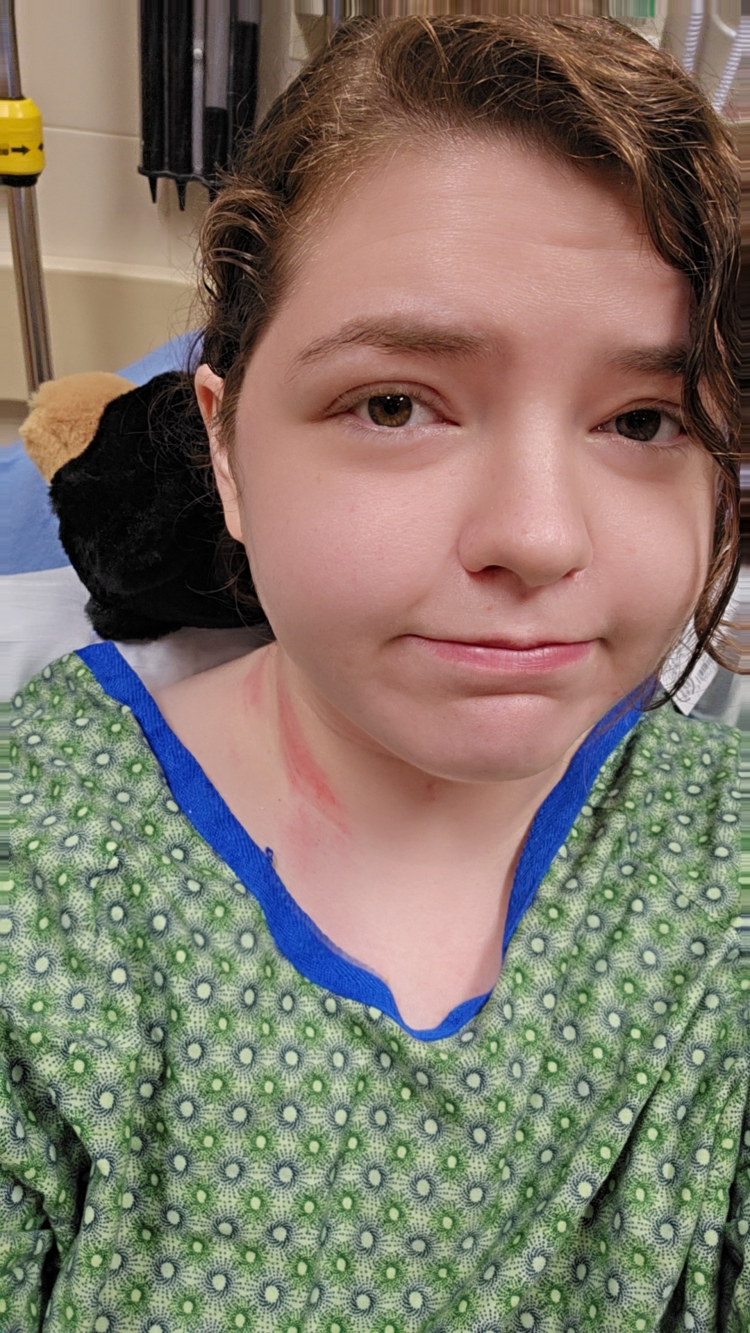 Recover from a wrecked car and semi-wrecked life campaign photo, 2 of 5