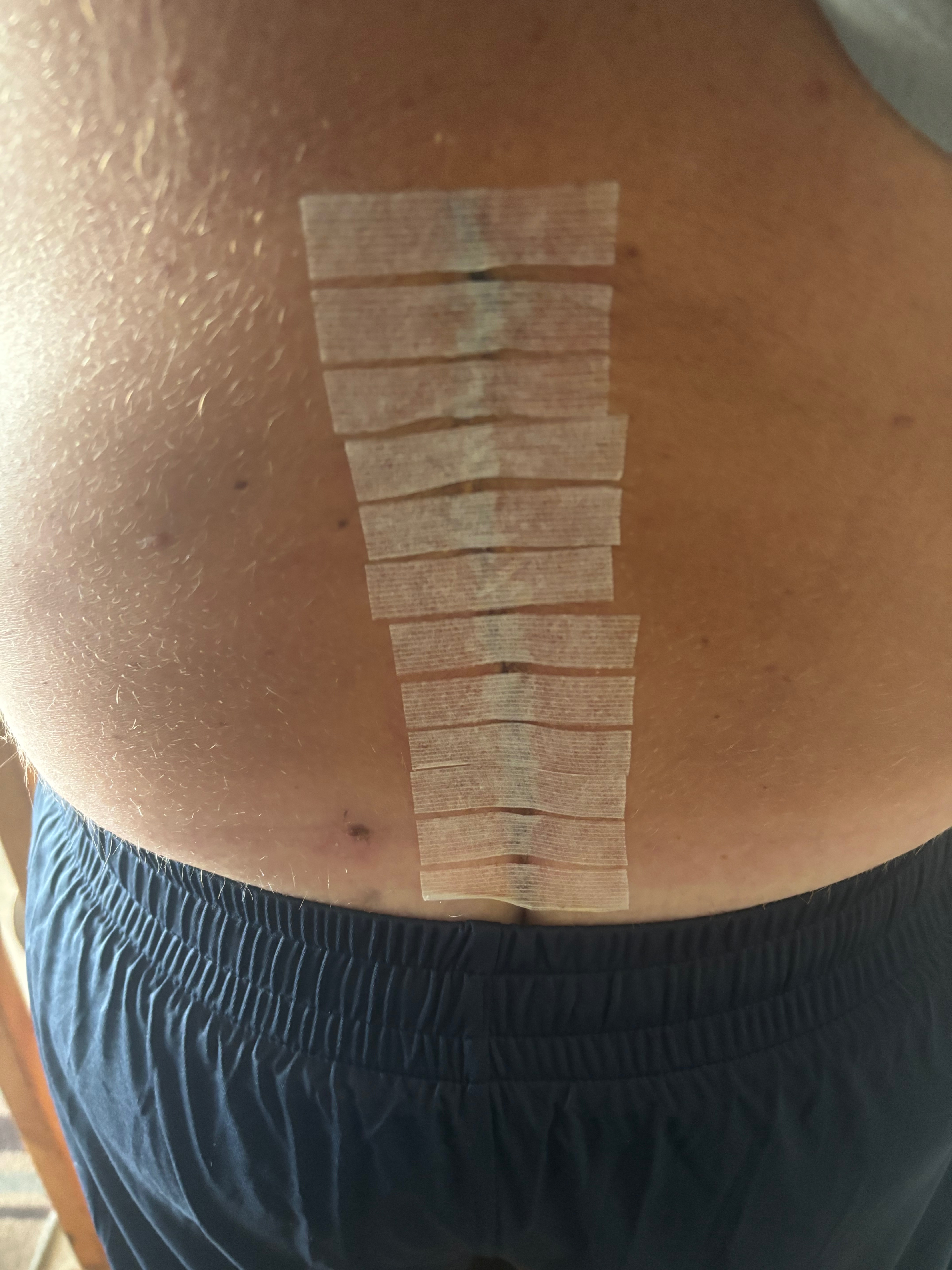 Support Jerome's Battle with Failed Surgeries campaign photo, 4 of 8