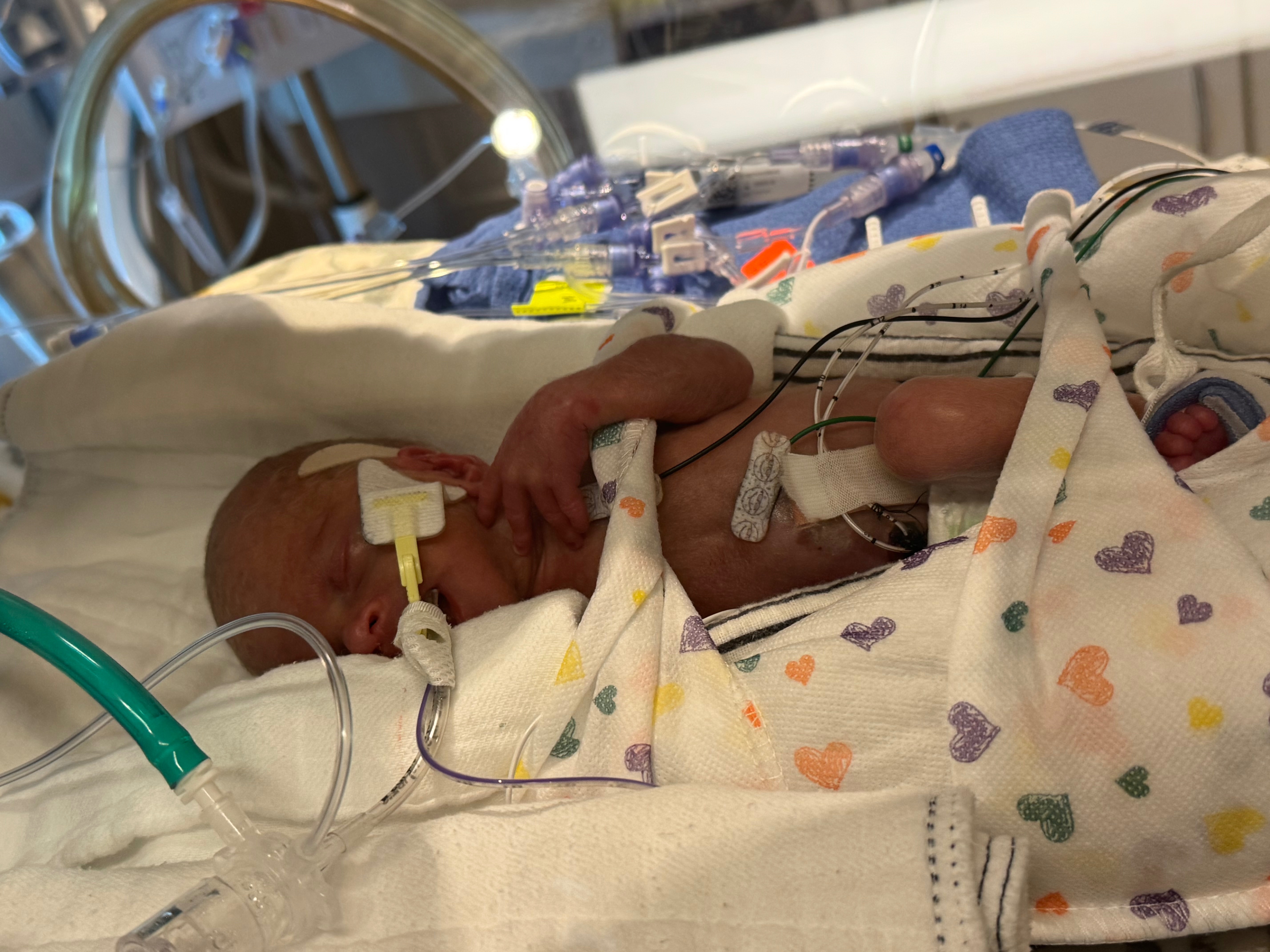Support Ryan and Channa during NICU stay campaign photo, 2 of 6