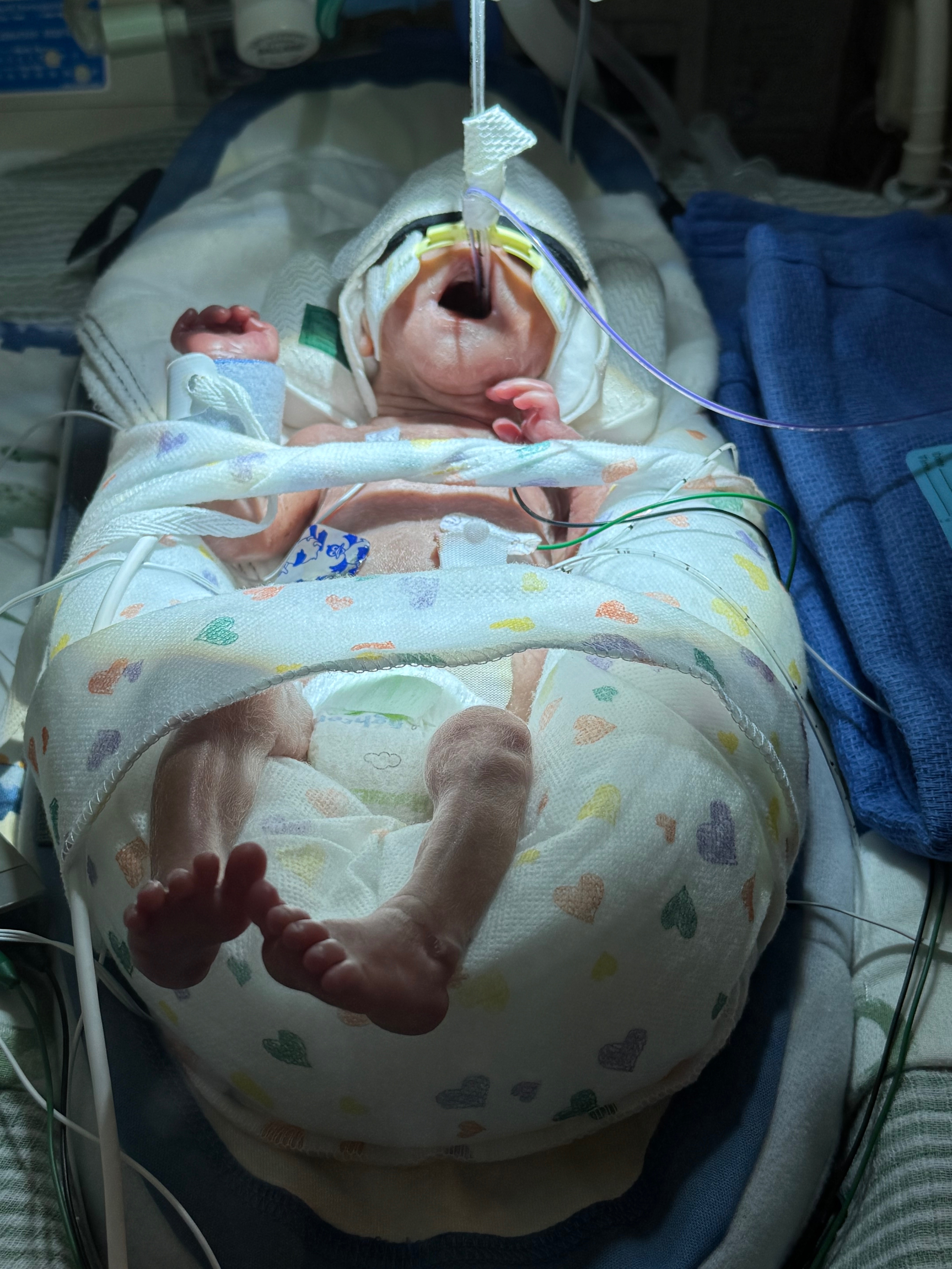 Support Ryan and Channa during NICU stay campaign photo, 4 of 6