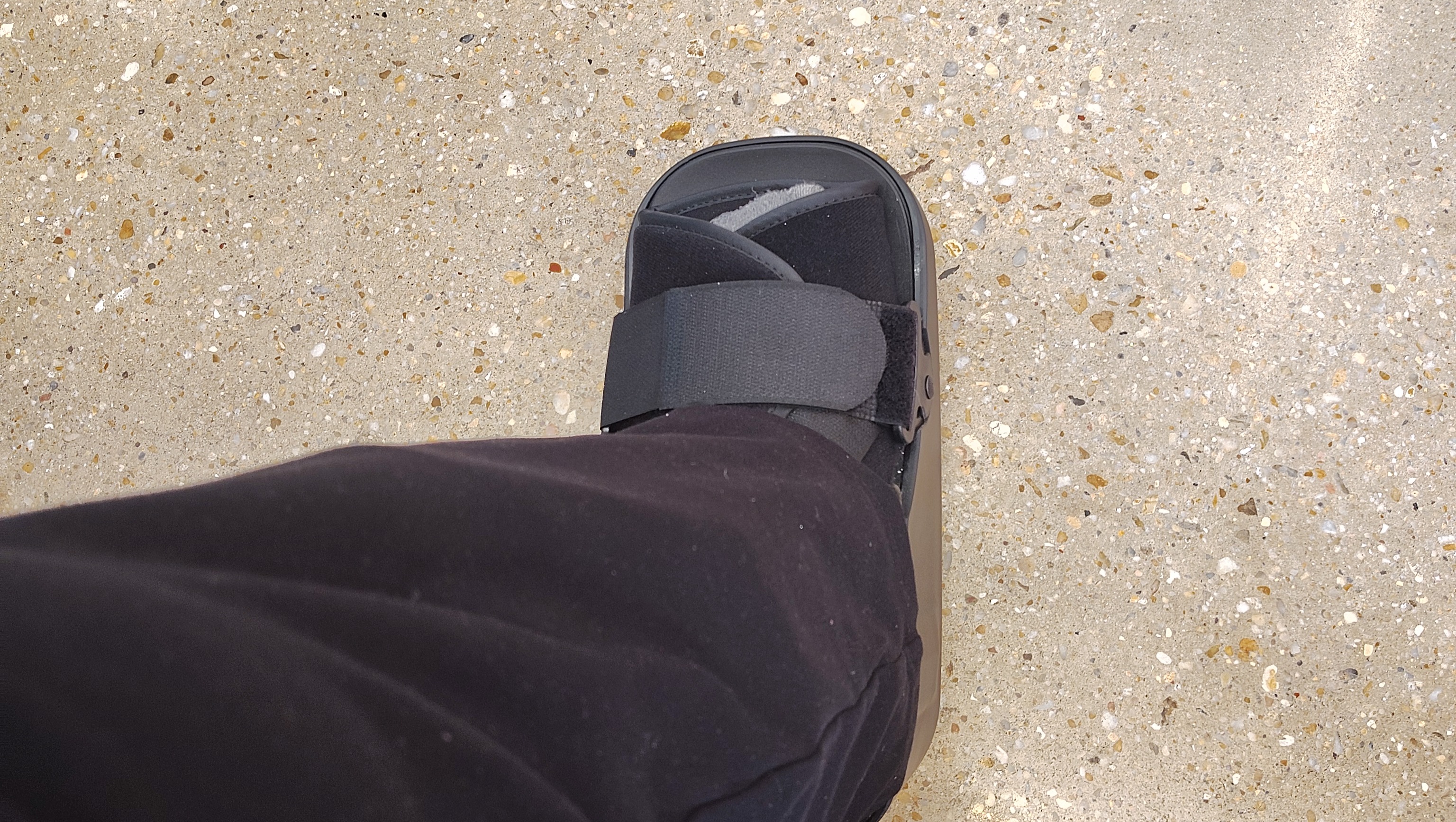 Help Sonya land on her feet-Having Ankle Foot Surgery photo