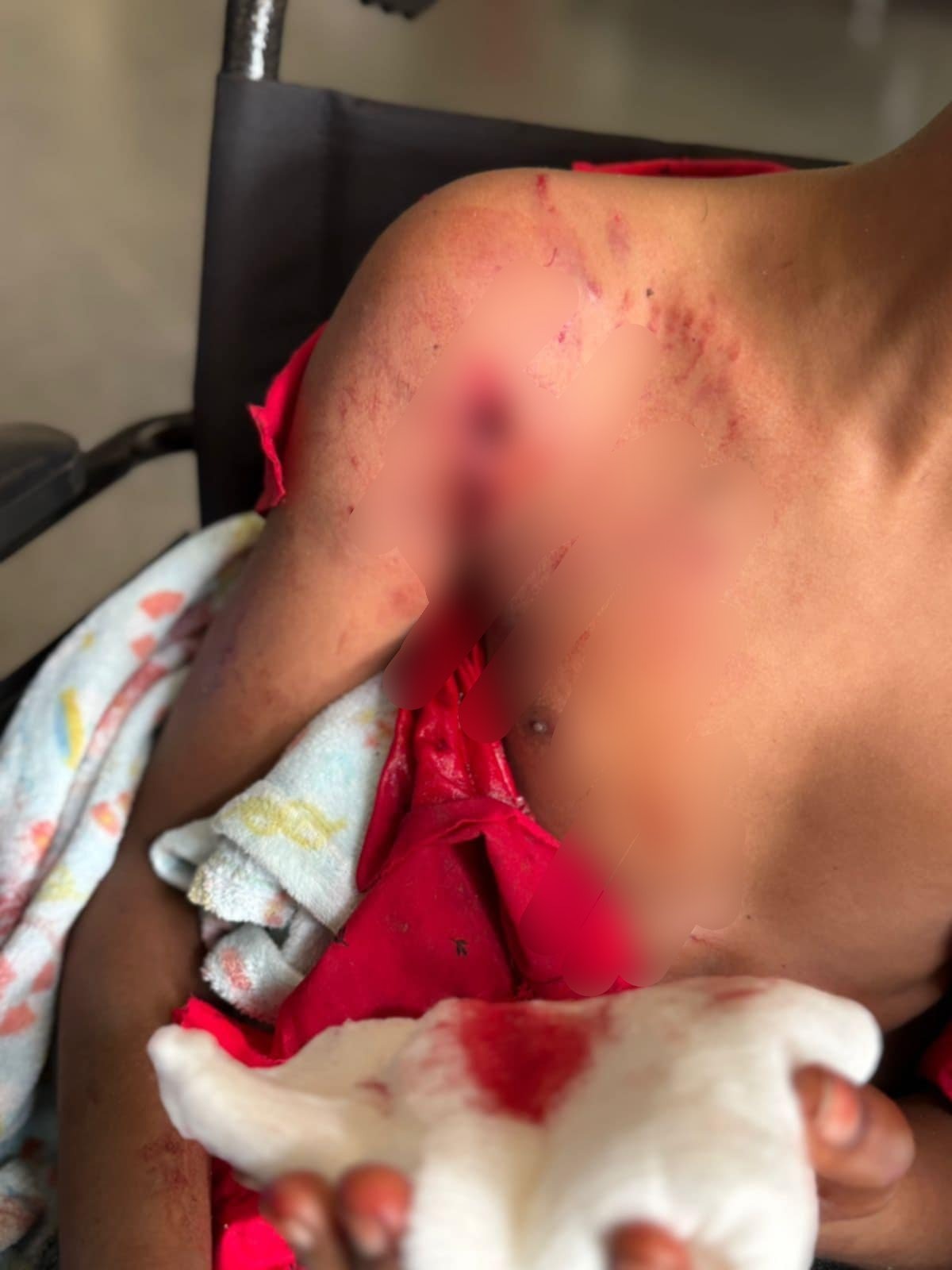 Help Ravin Recover from Rottweiler Attack campaign photo, 2 of 7