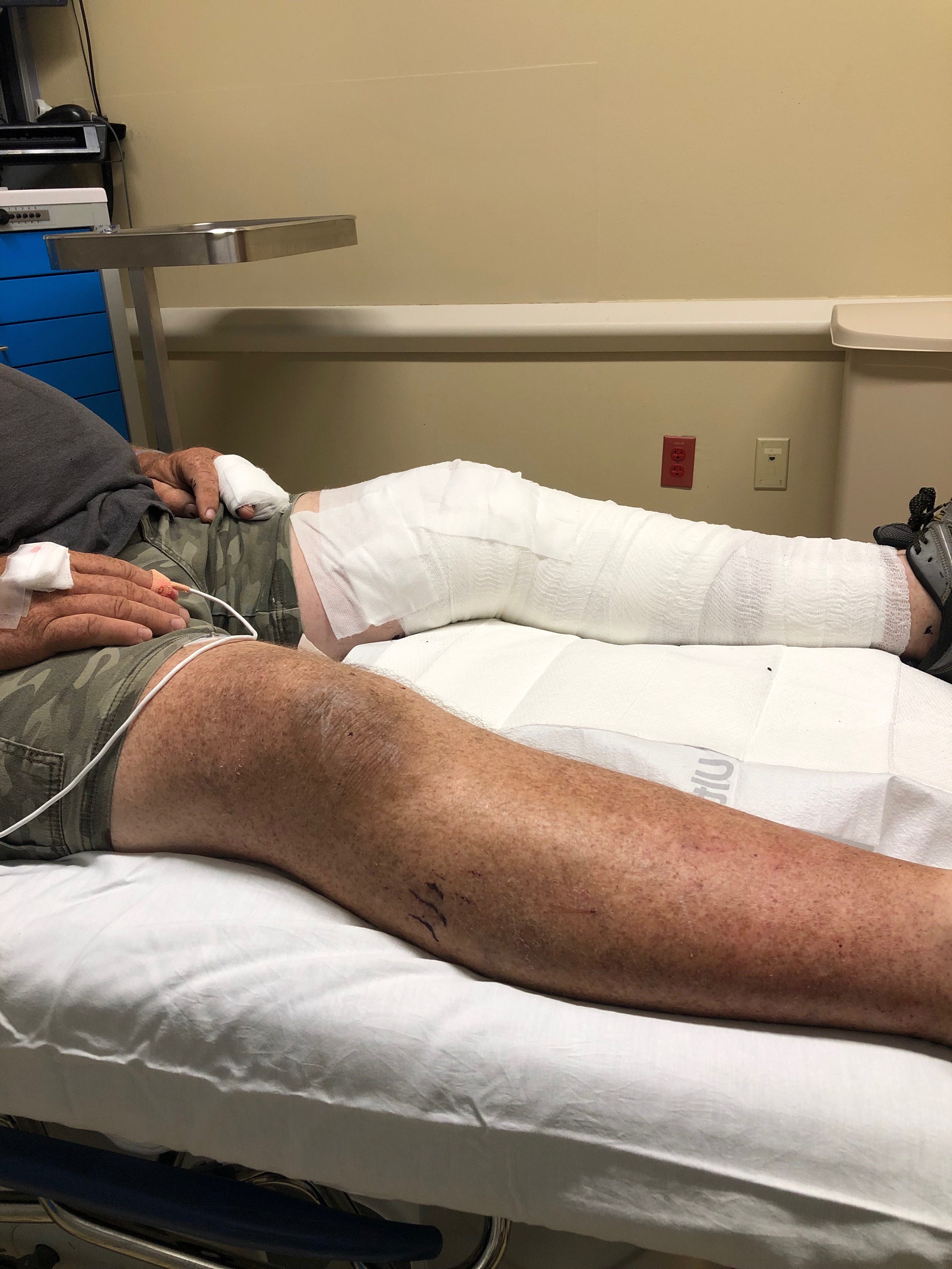 Support Wes Oglesby's Burn Recovery Journey campaign photo, 4 of 4