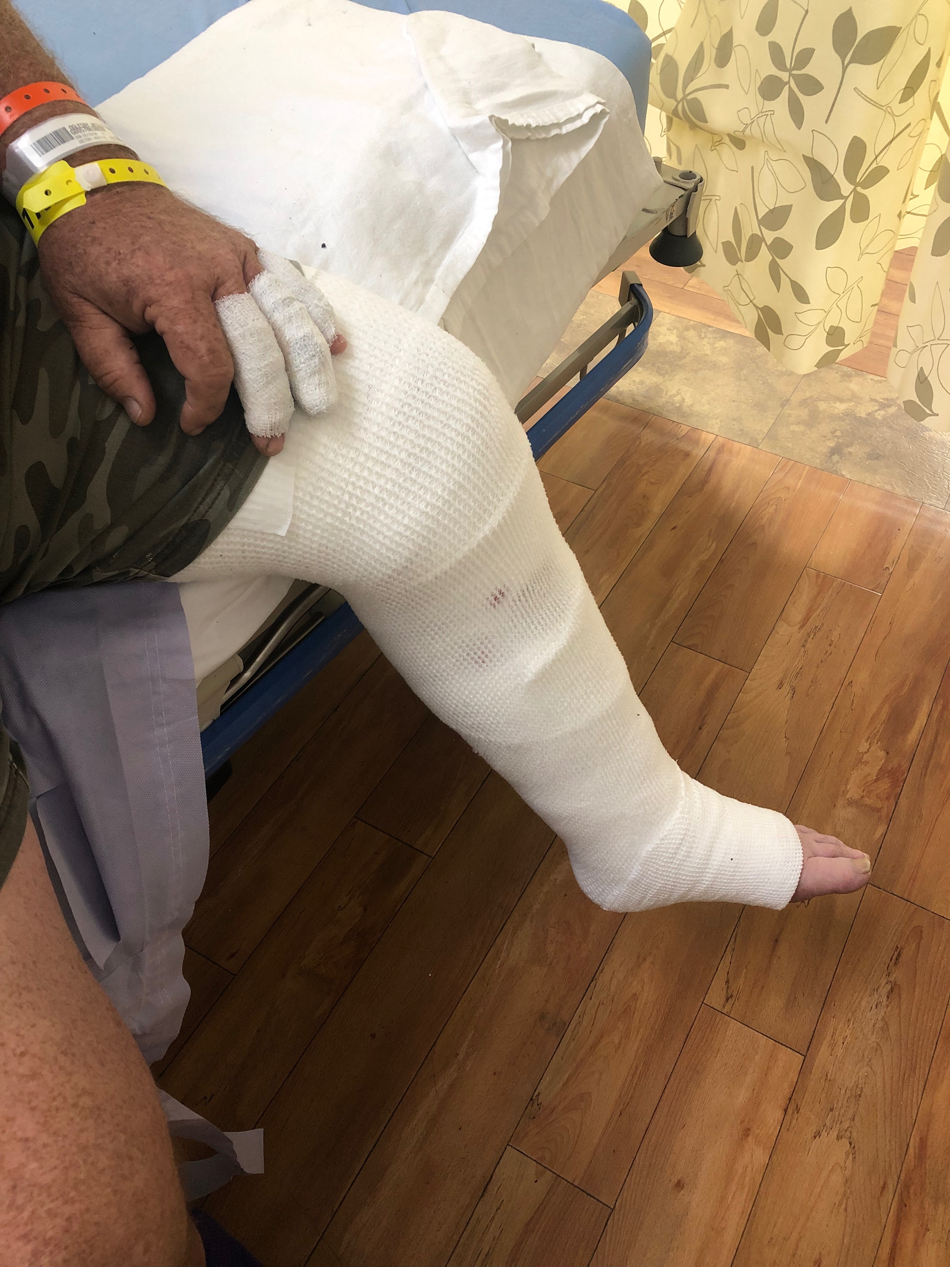 Support Wes Oglesby's Burn Recovery Journey campaign photo, 2 of 4