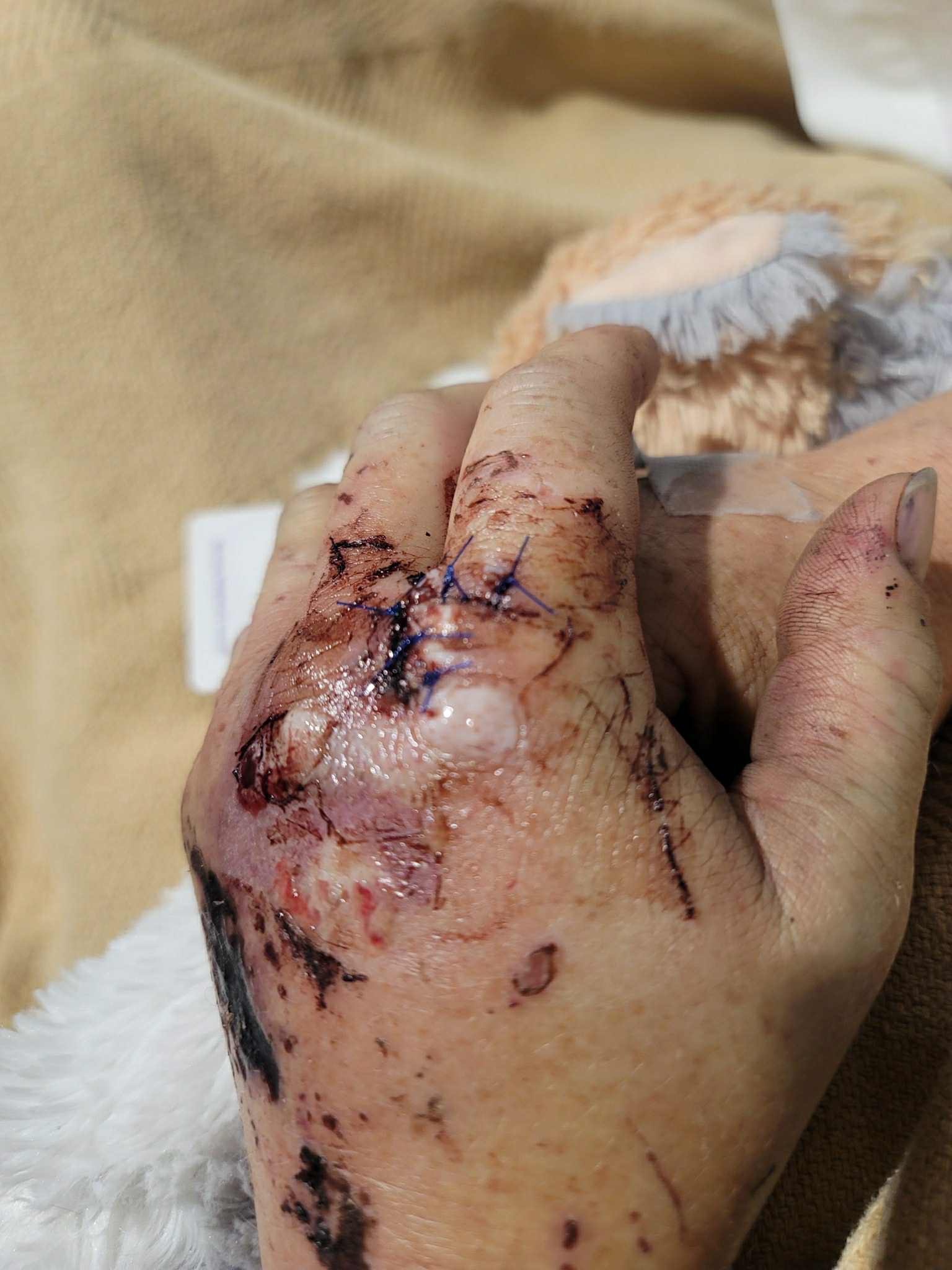 Help Lynette Heal After Devastating Accident campaign photo, 4 of 5