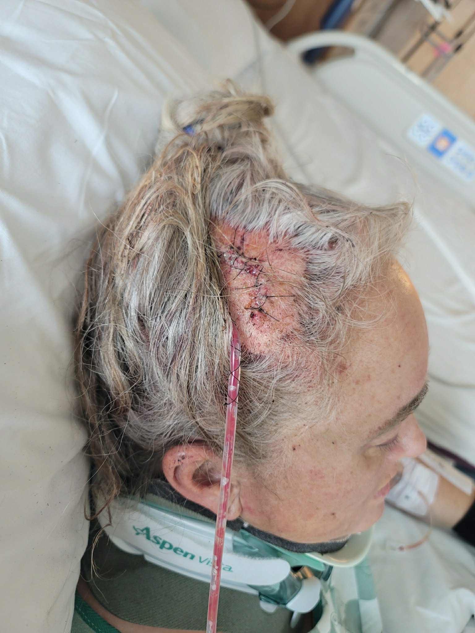 Help Lynette Heal After Devastating Accident campaign photo, 2 of 5