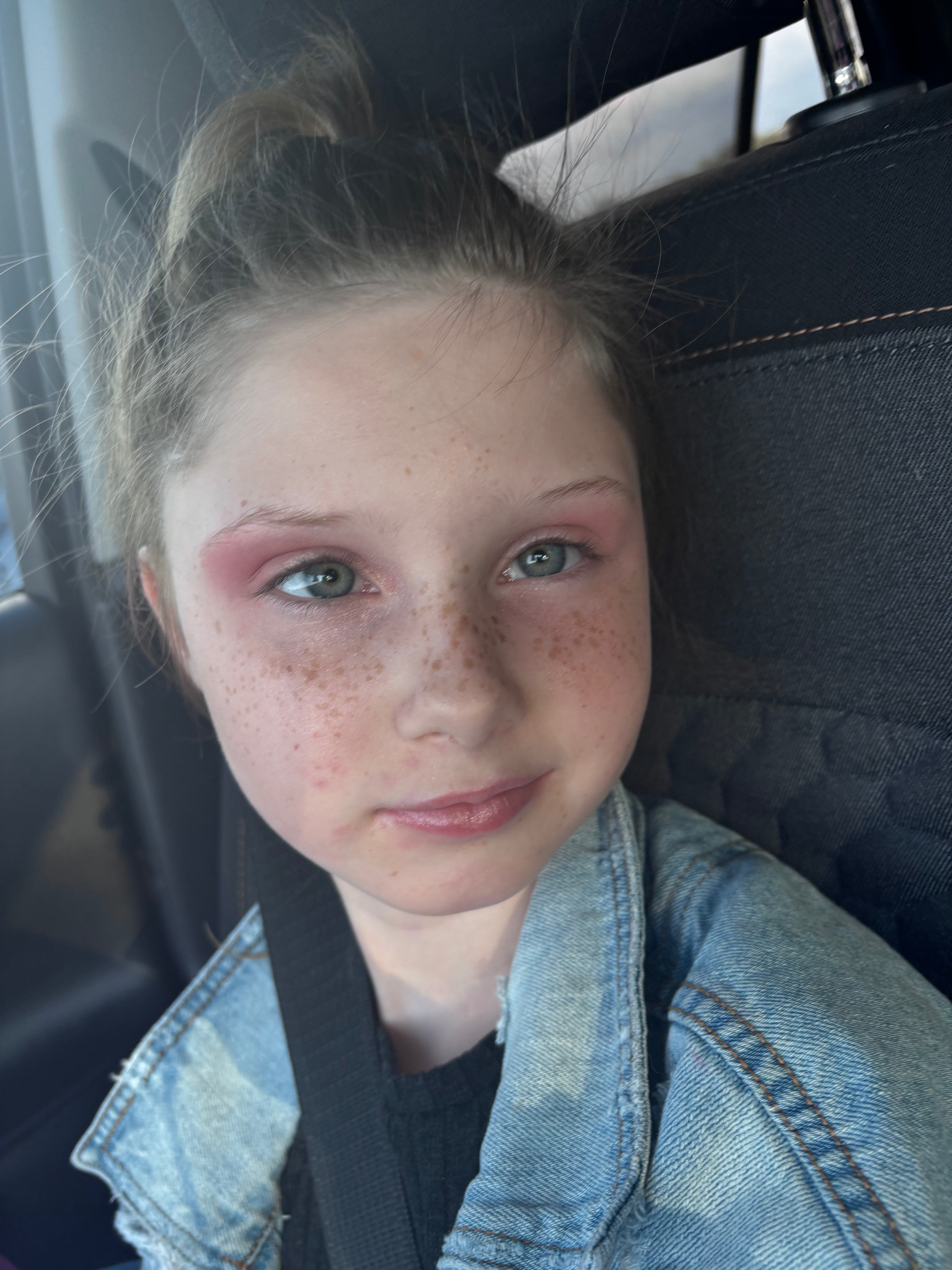 Watching My Daughter Struggle to See Breaks My Heart campaign photo, 2 of 7