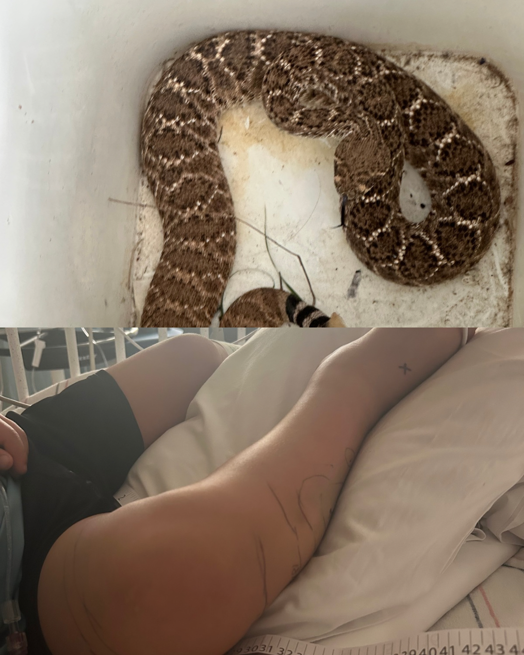 Donate to Little Leeland’s Snake Bite Recovery campaign photo, 6 of 8
