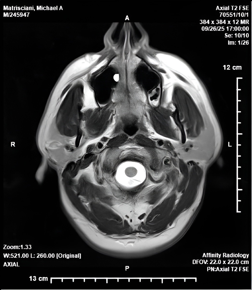 Help Mike recover from brain surgery. campaign photo, 4 of 5