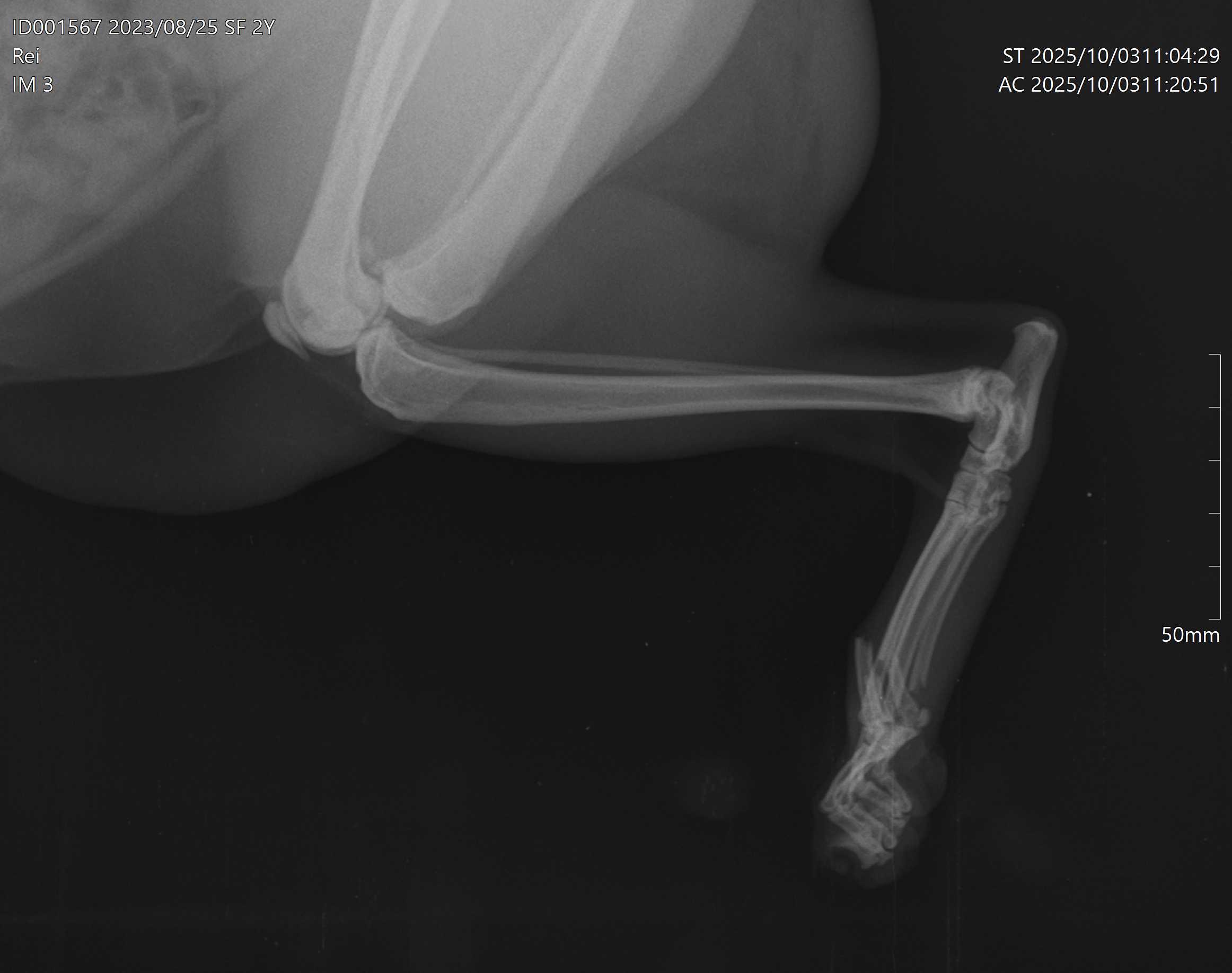 Rei broke three bones and needs surgery campaign photo, 5 of 6