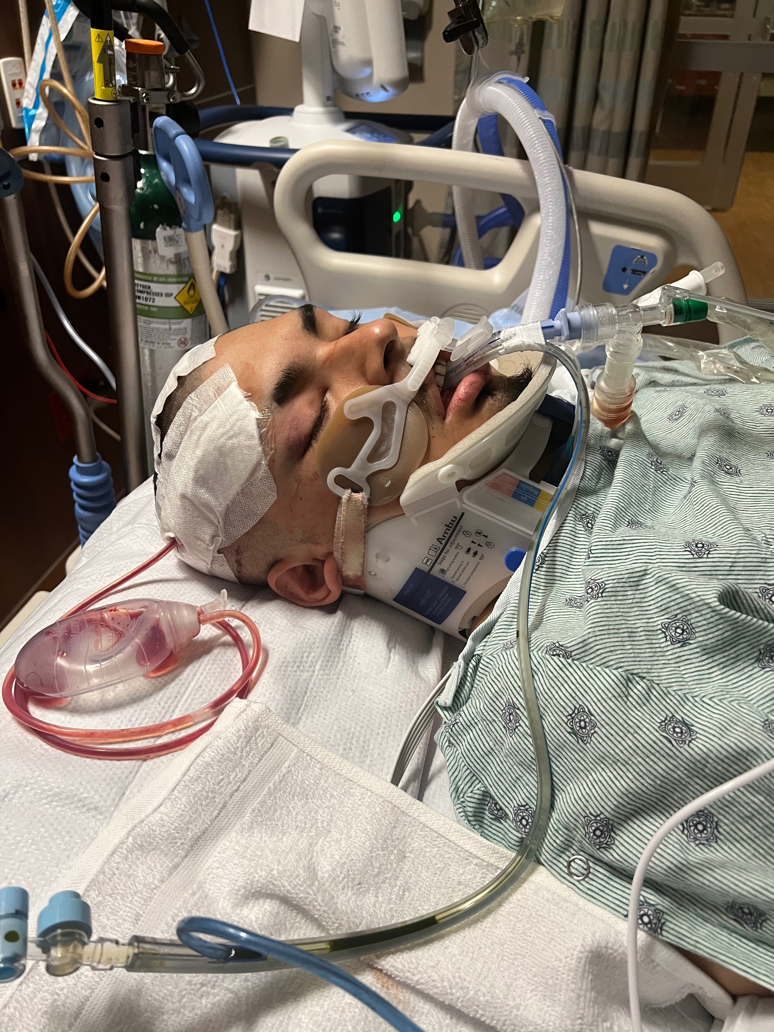 Please help with Allan’s Medical and Family expenses campaign photo, 4 of 7