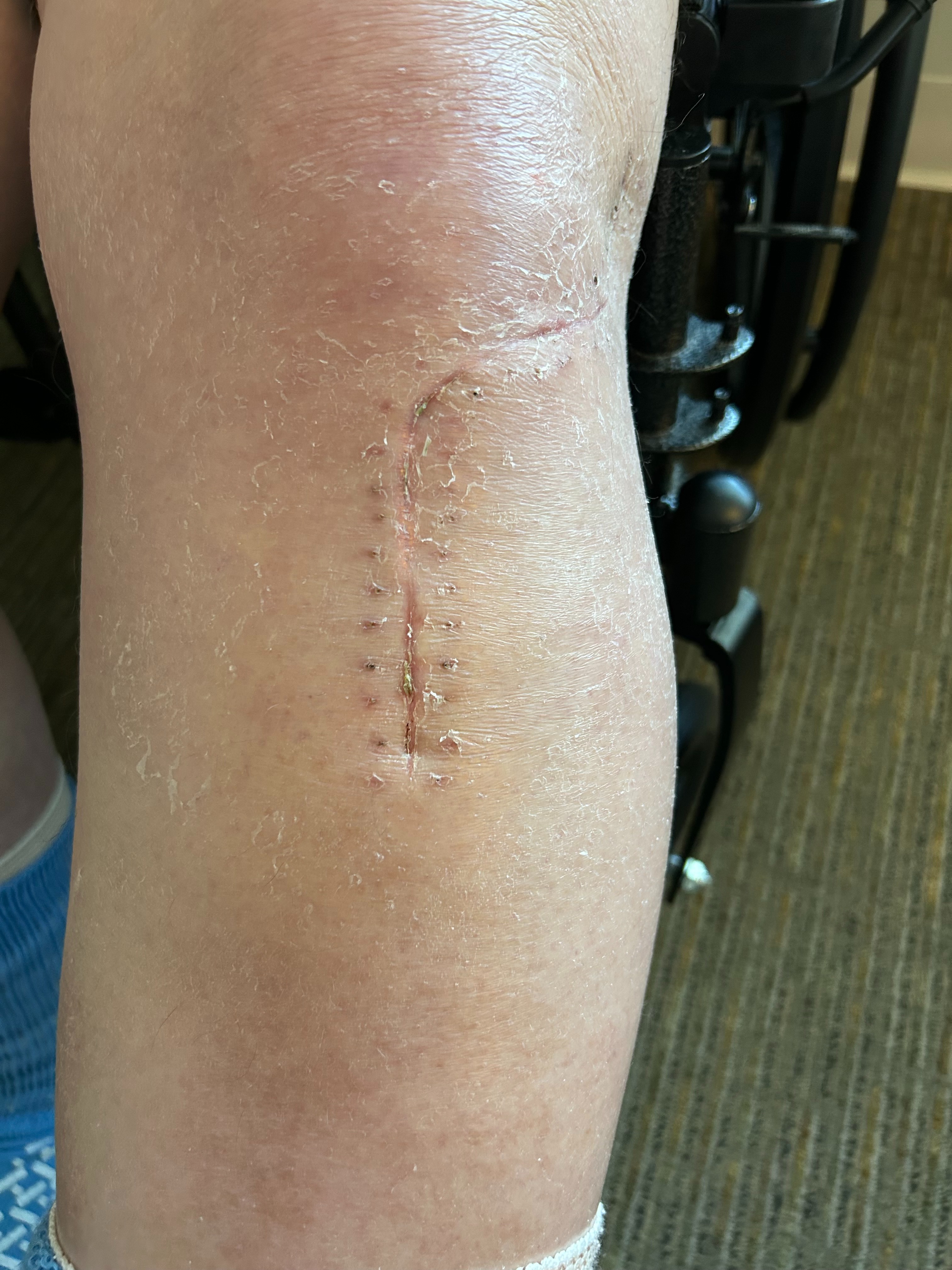 Support Woodrow Wilcox's Recovery Journey campaign photo, 2 of 4