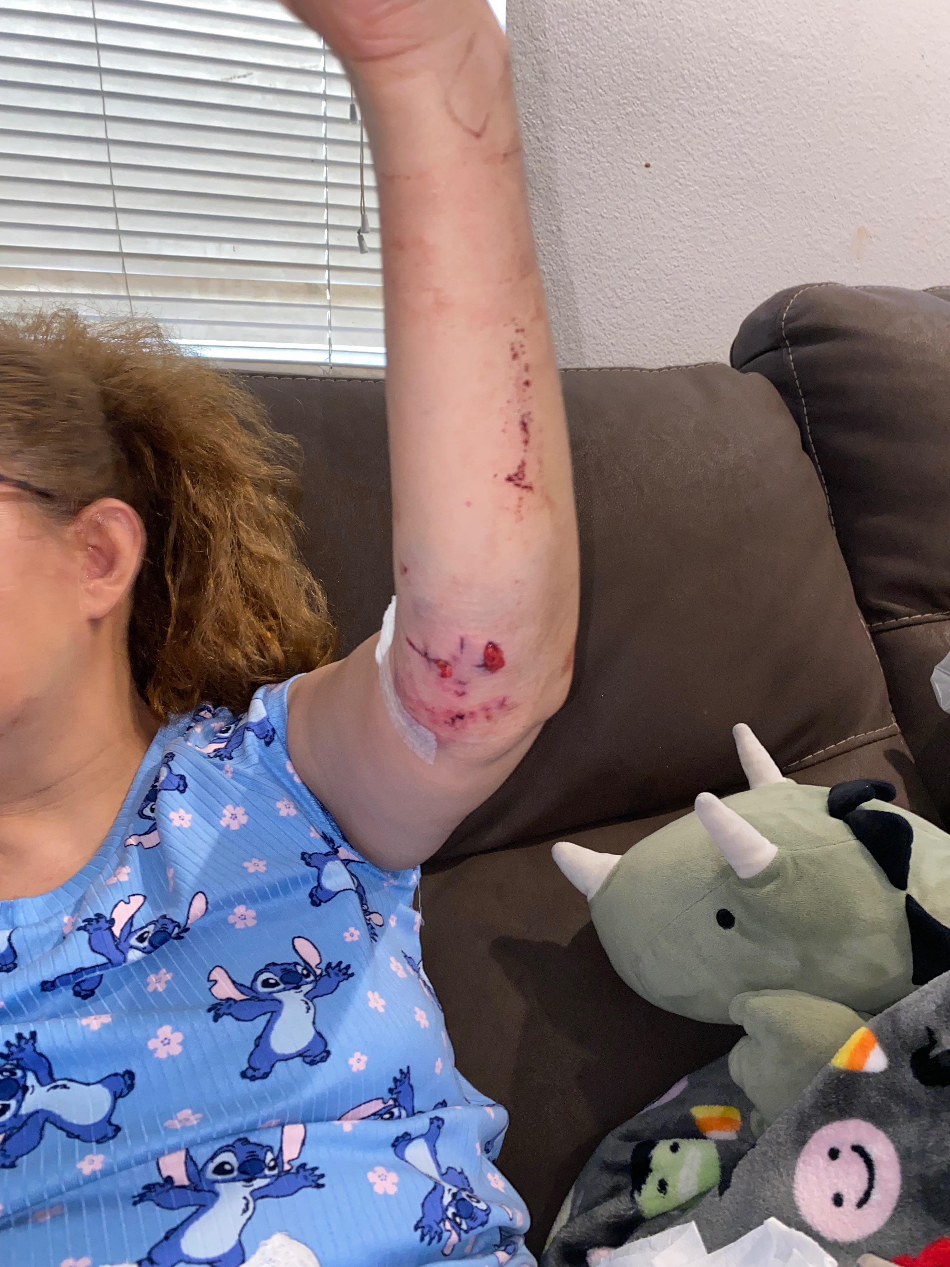 Help Teresa Heredia Recover from Dog Attack campaign photo, 5 of 6