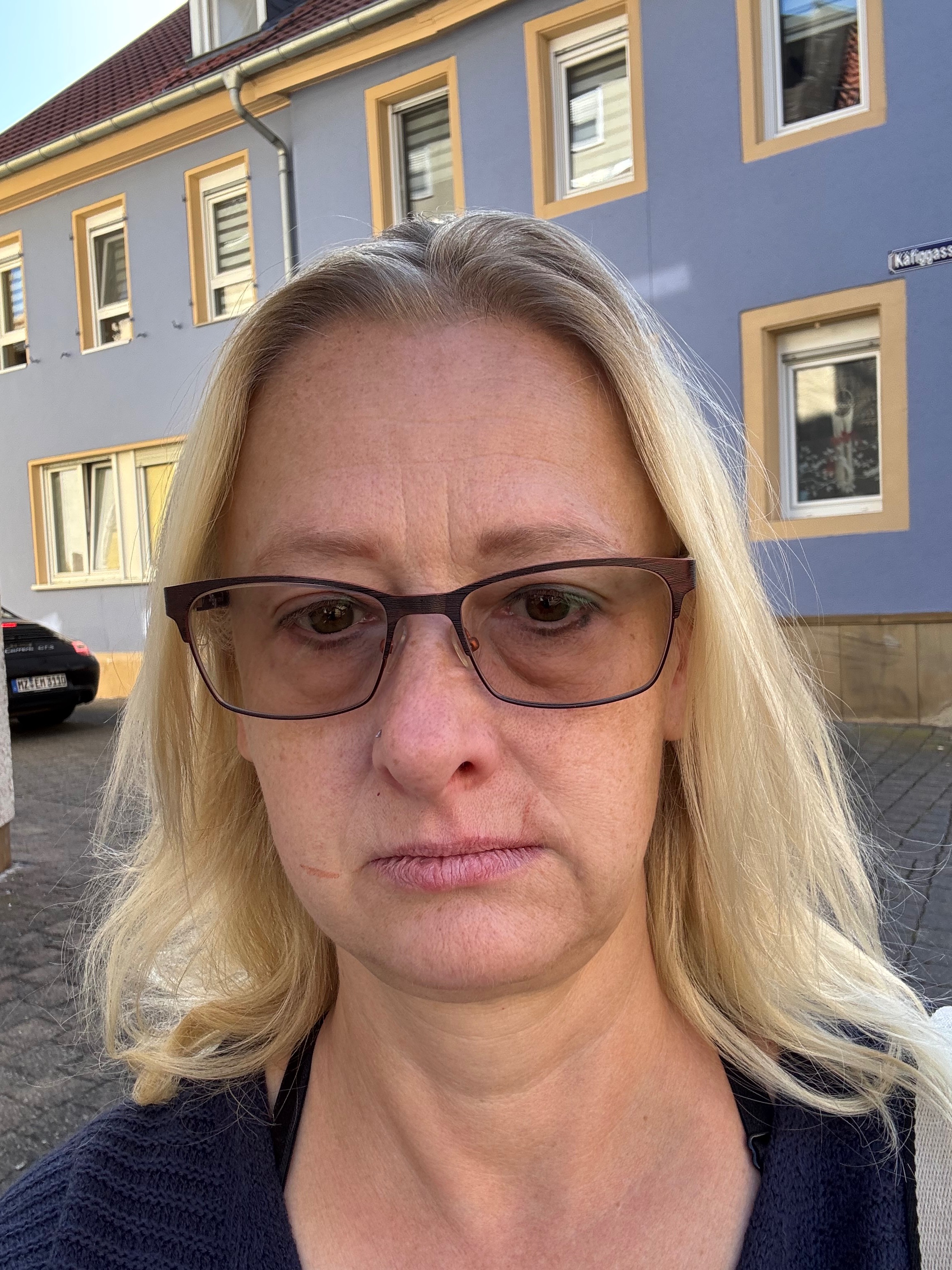 Wieder lächeln können - Zahnaufbau campaign photo, 2 of 4