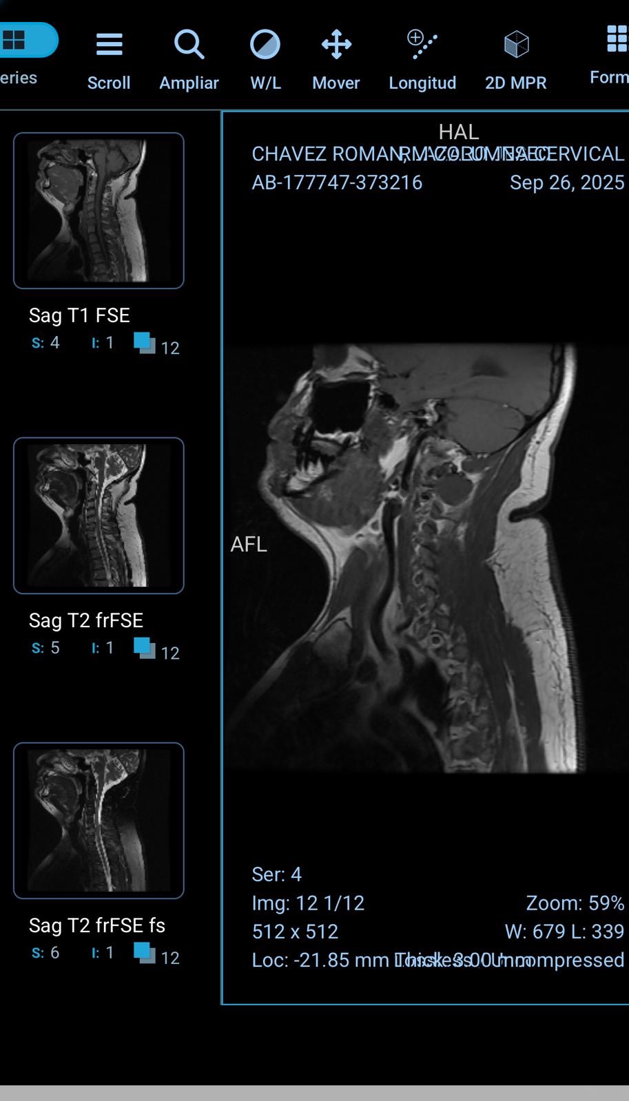 Urgent Help for My Brother’s Surgery in Mexico (C6 Spinal Fr campaign photo, 5 of 8
