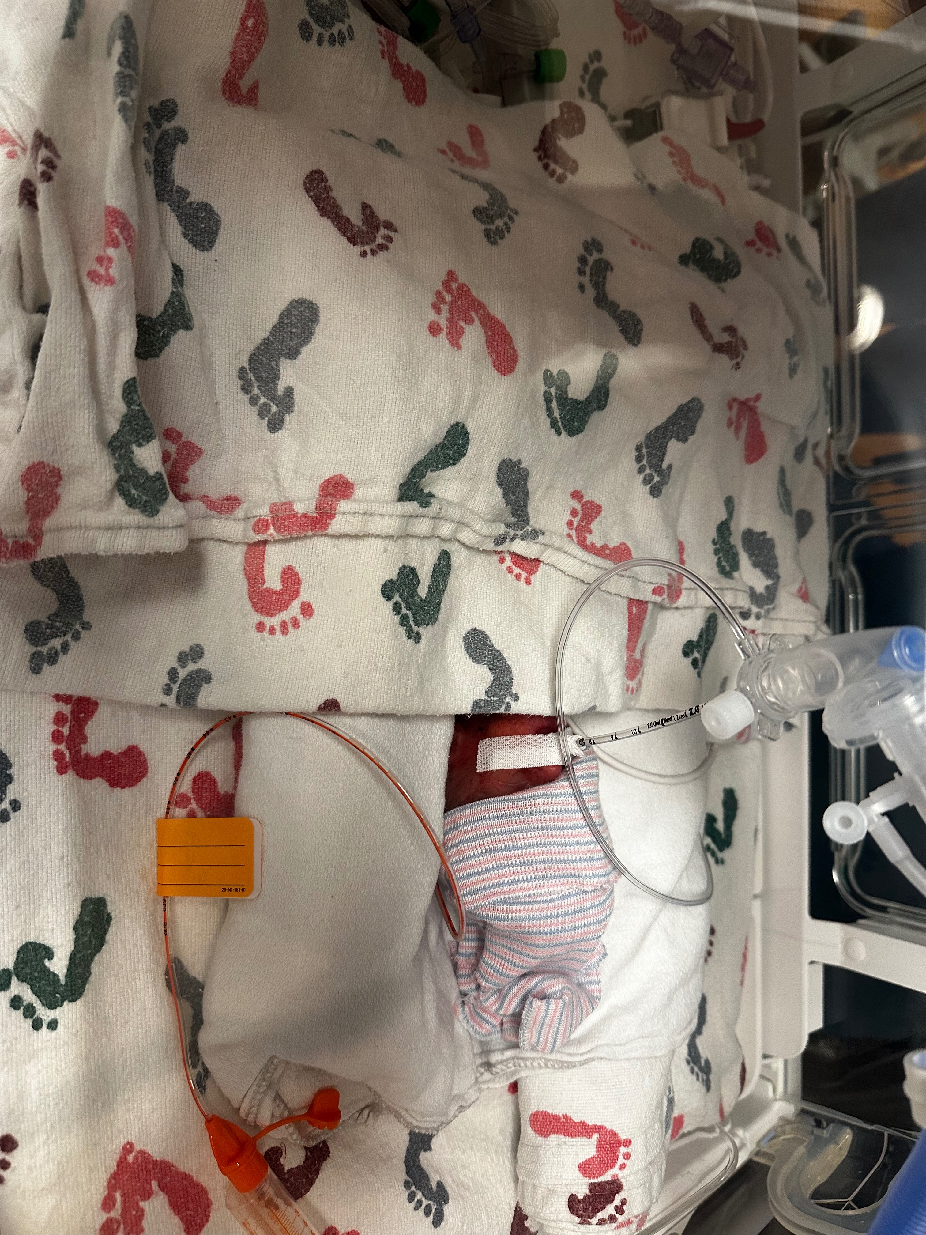 Support Kennadi and Maverick's NICU Journey campaign photo, 2 of 5