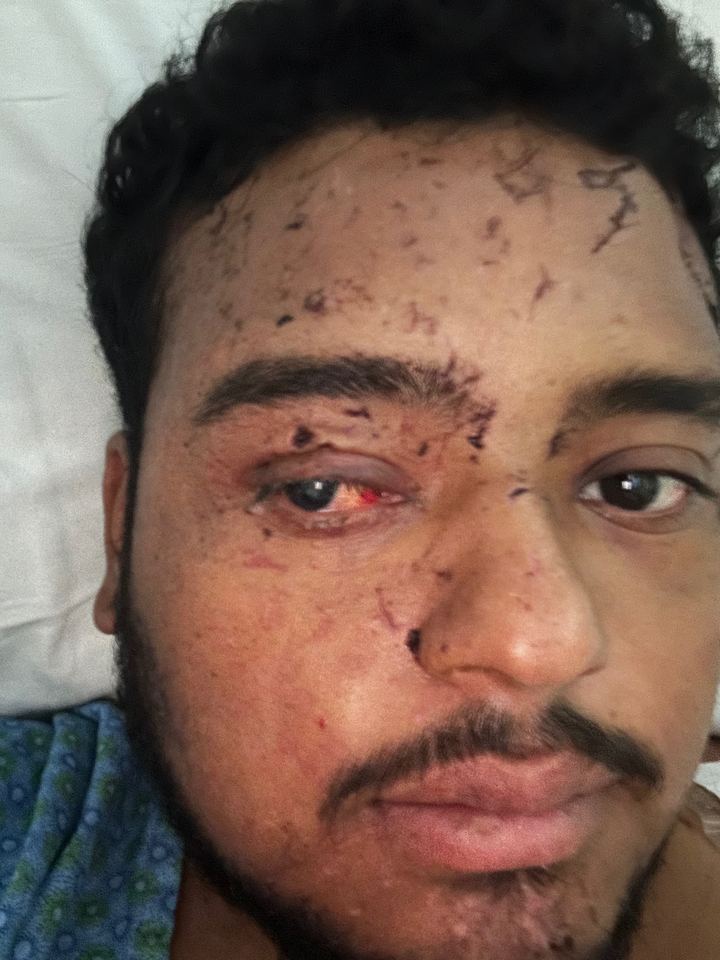 Help Overcome Injuries from Severe Accident campaign photo, 7 of 8