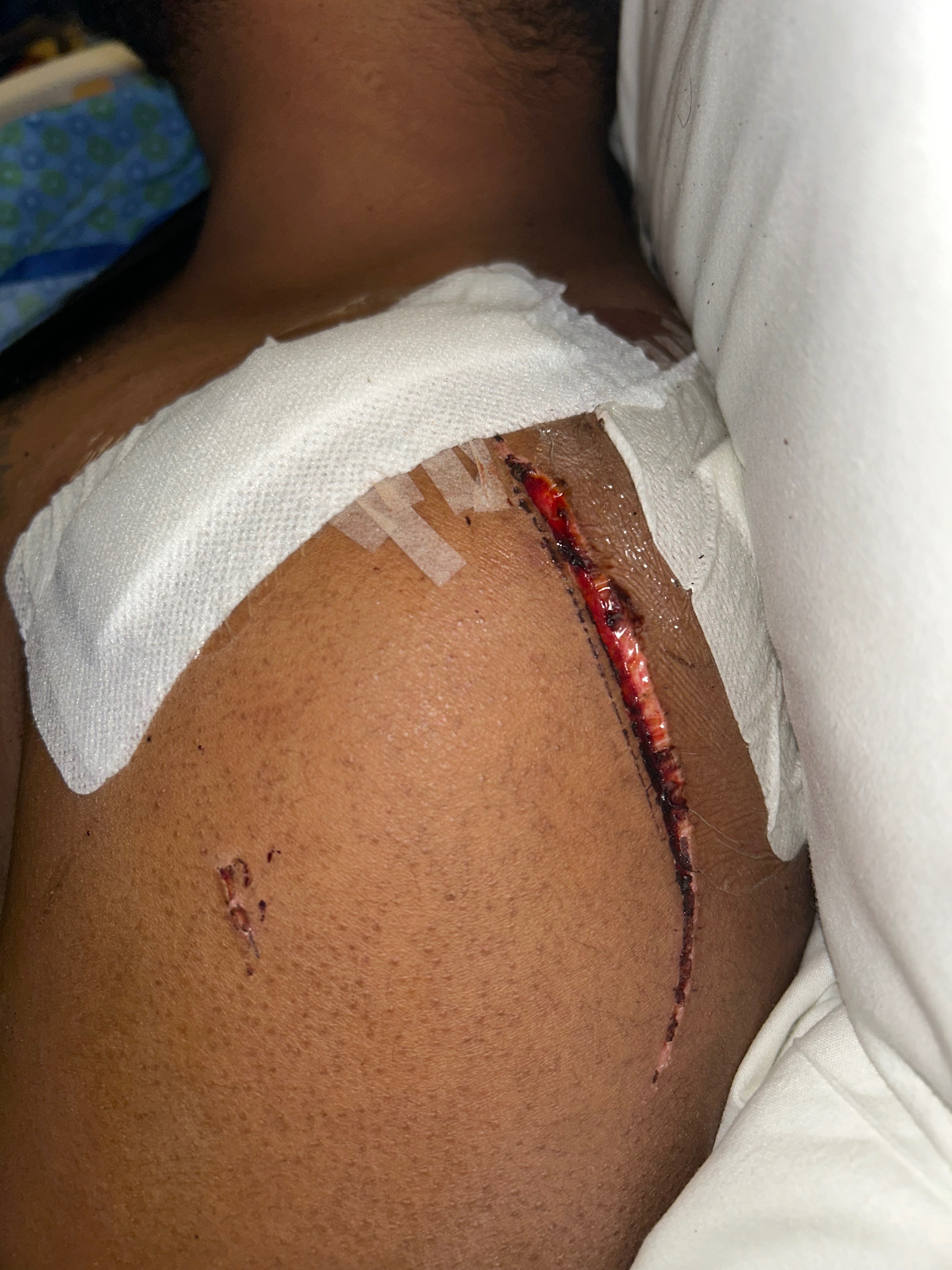 Help Overcome Injuries from Severe Accident campaign photo, 2 of 8