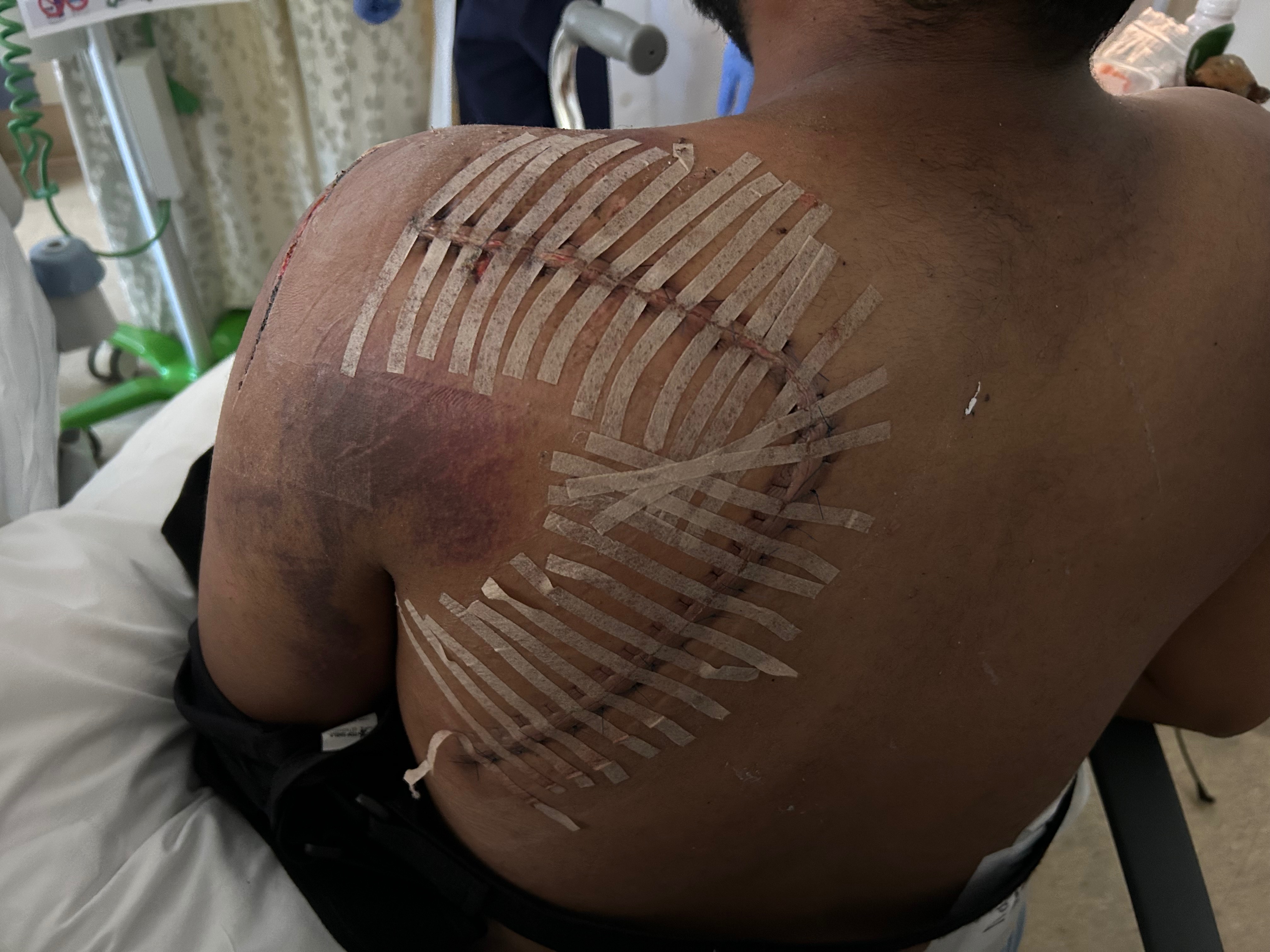 Help Overcome Injuries from Severe Accident campaign photo, 4 of 8