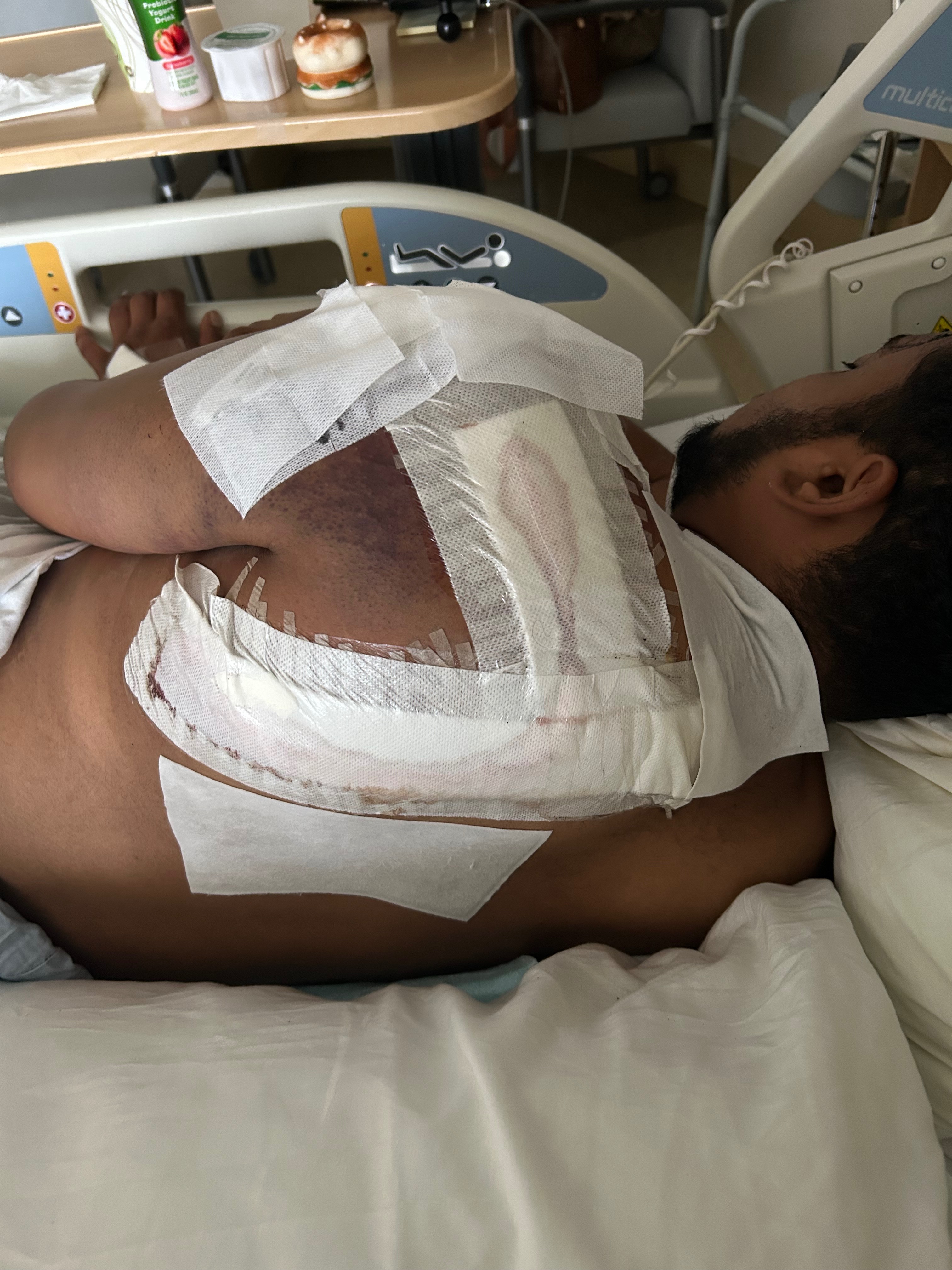 Help Overcome Injuries from Severe Accident campaign photo, 5 of 8