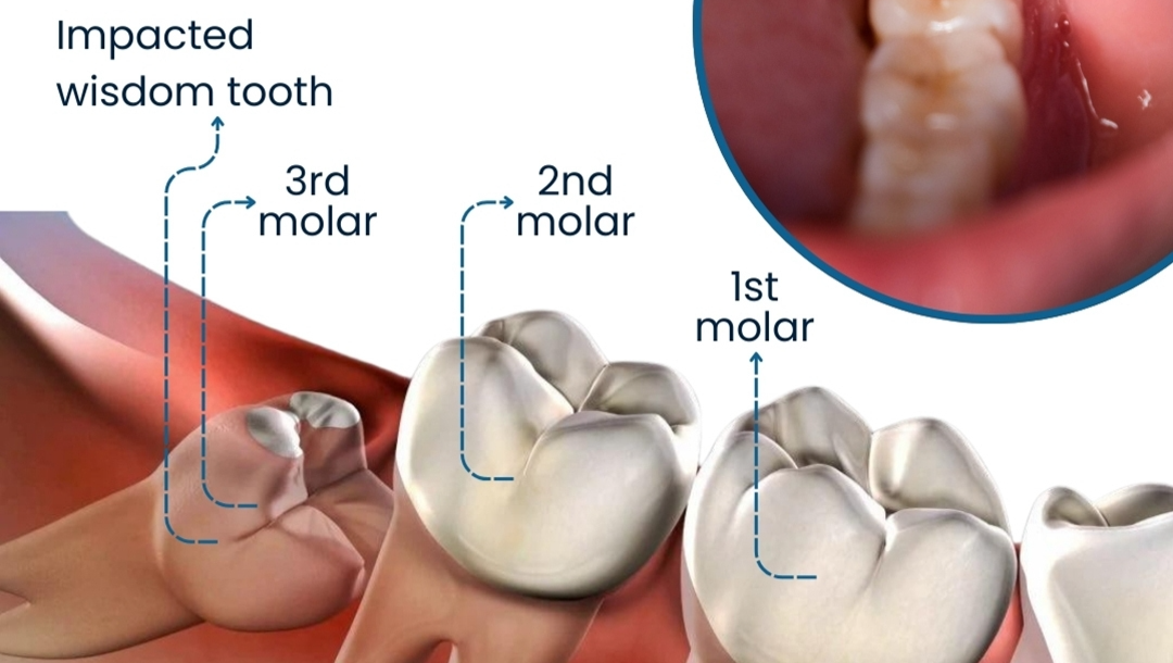 Help Ziona Smith Pay Off Urgent Dental Surgery