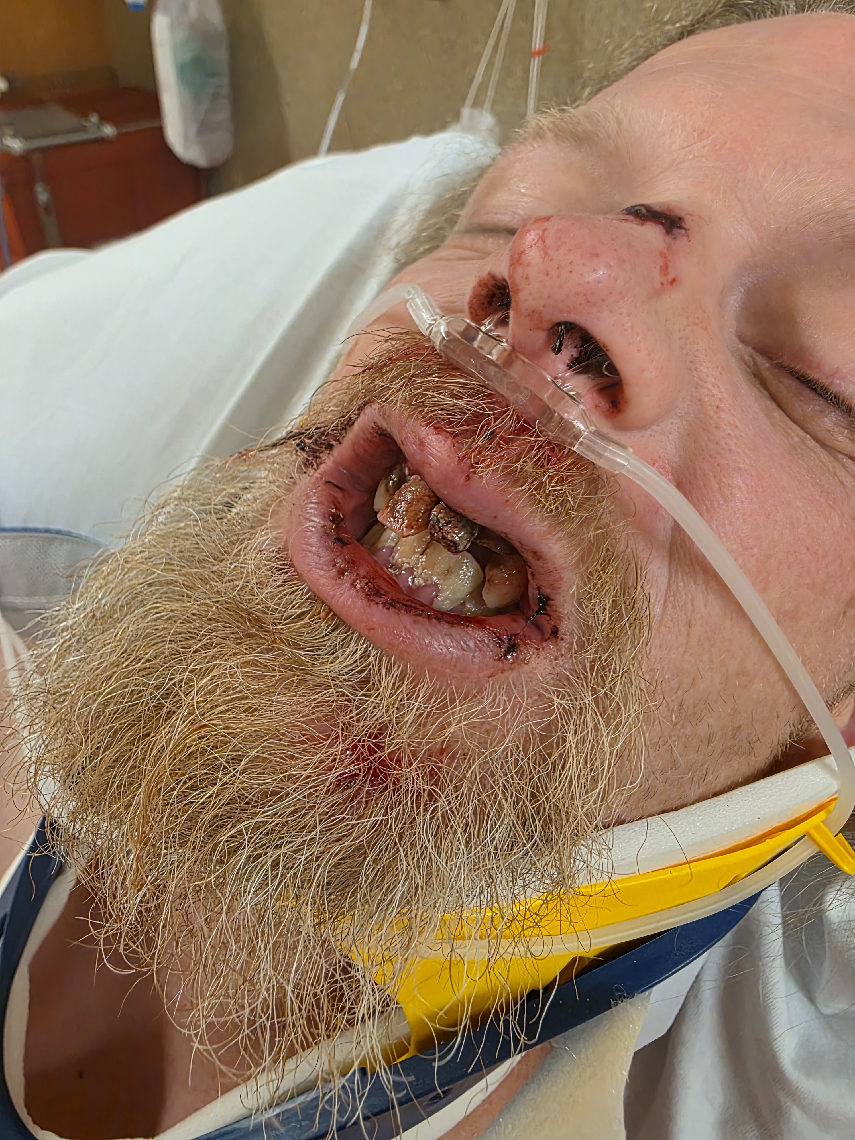 Support Justin’s Recovery and Family Needs campaign photo, 2 of 8