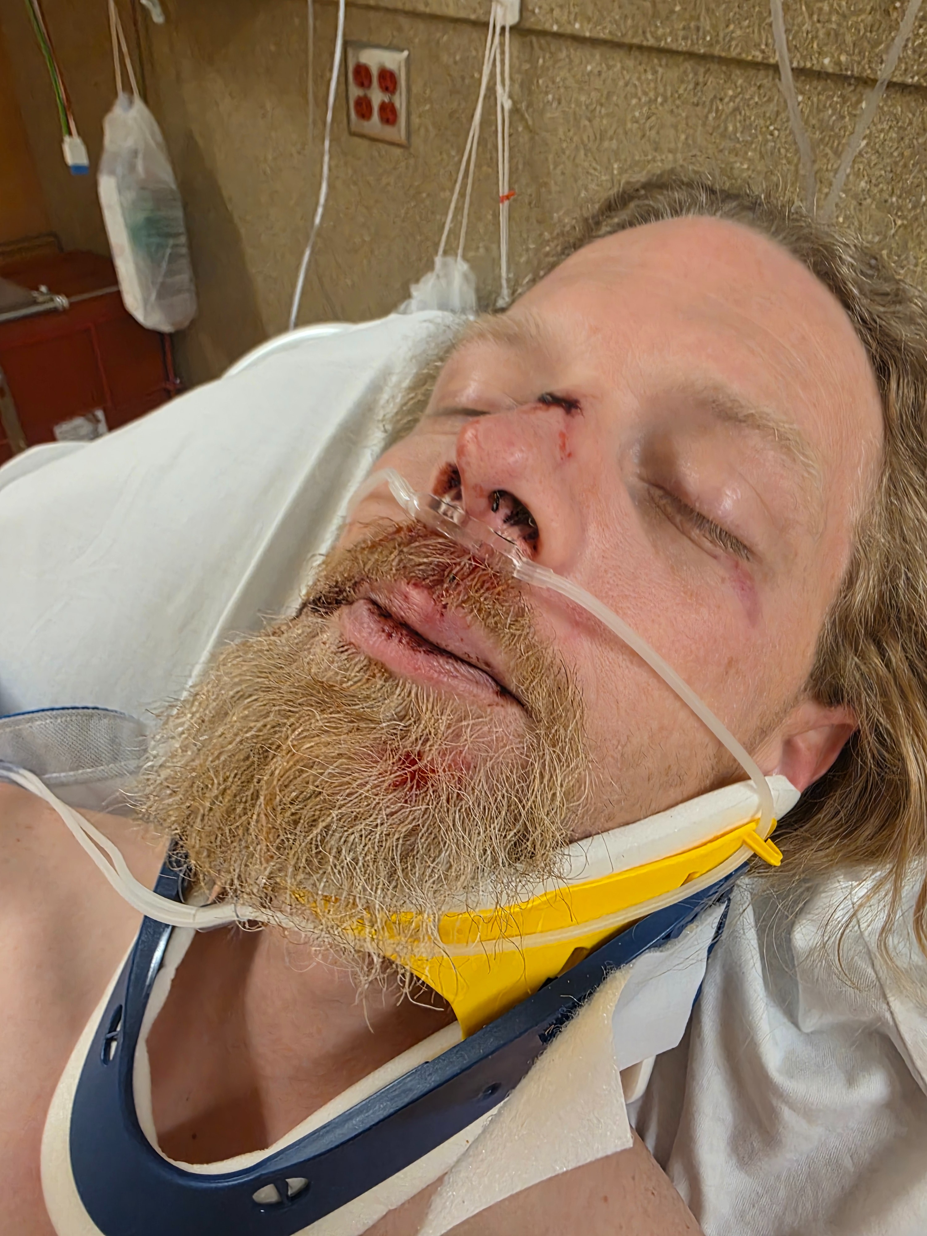 Support Justin’s Recovery and Family Needs campaign photo, 4 of 8