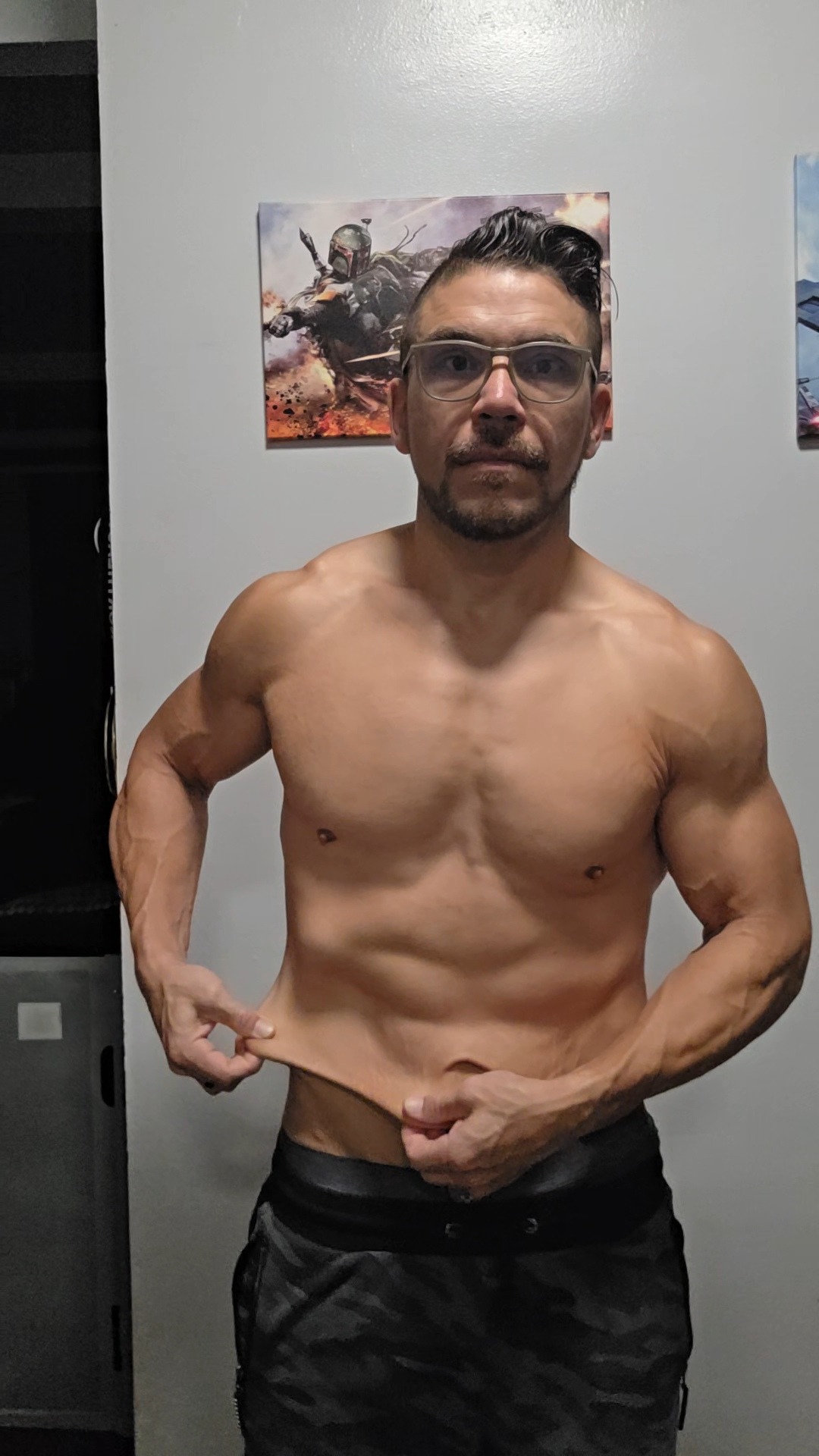 Victor's skin removal surgery campaign photo, 6 of 7