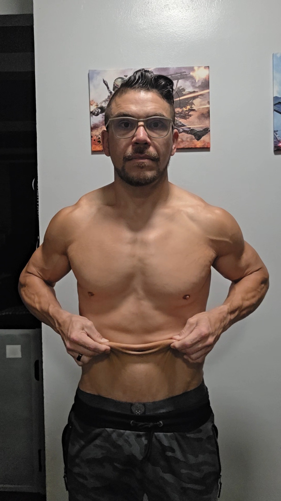 Victor's skin removal surgery campaign photo, 2 of 7