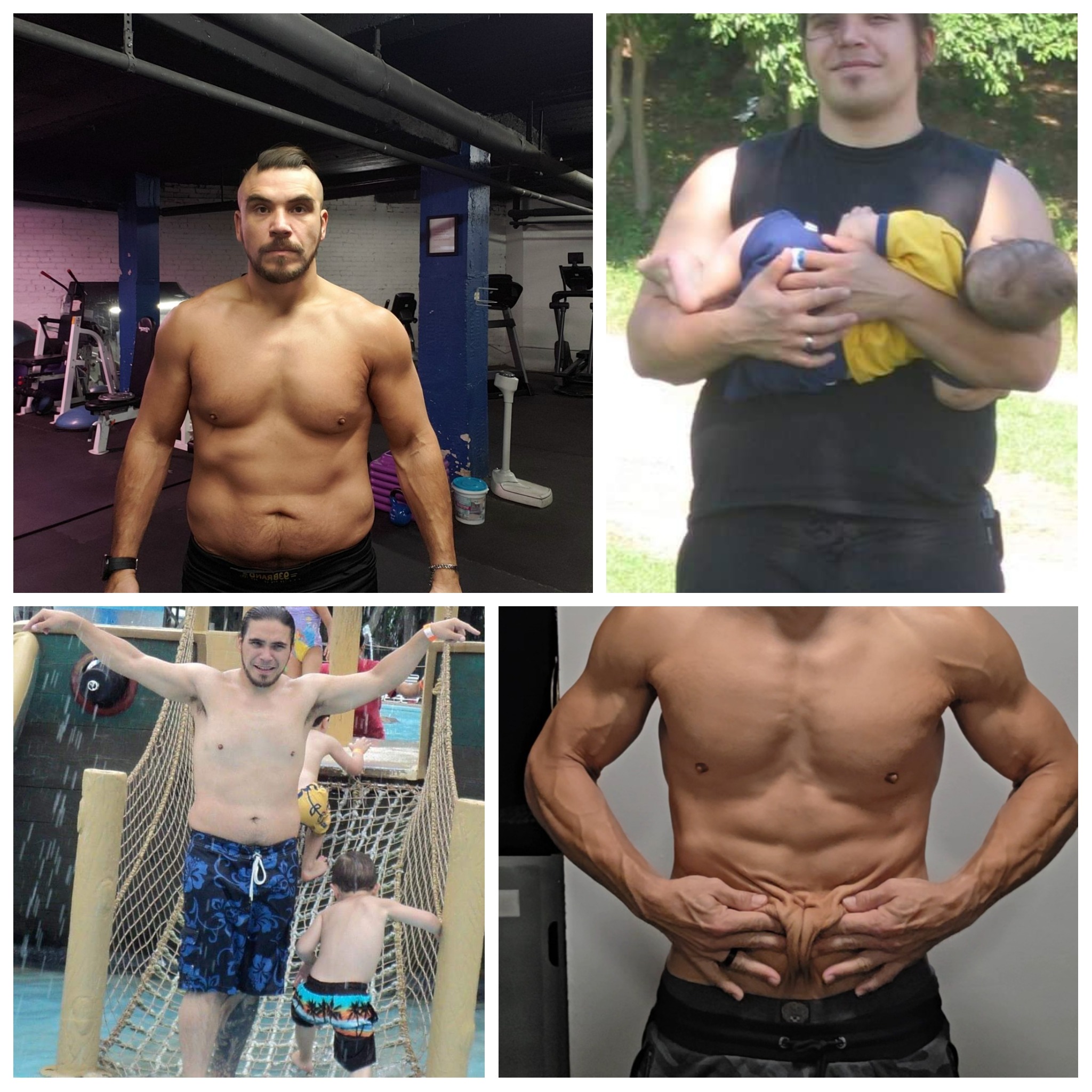 Victor's skin removal surgery campaign photo, 5 of 7