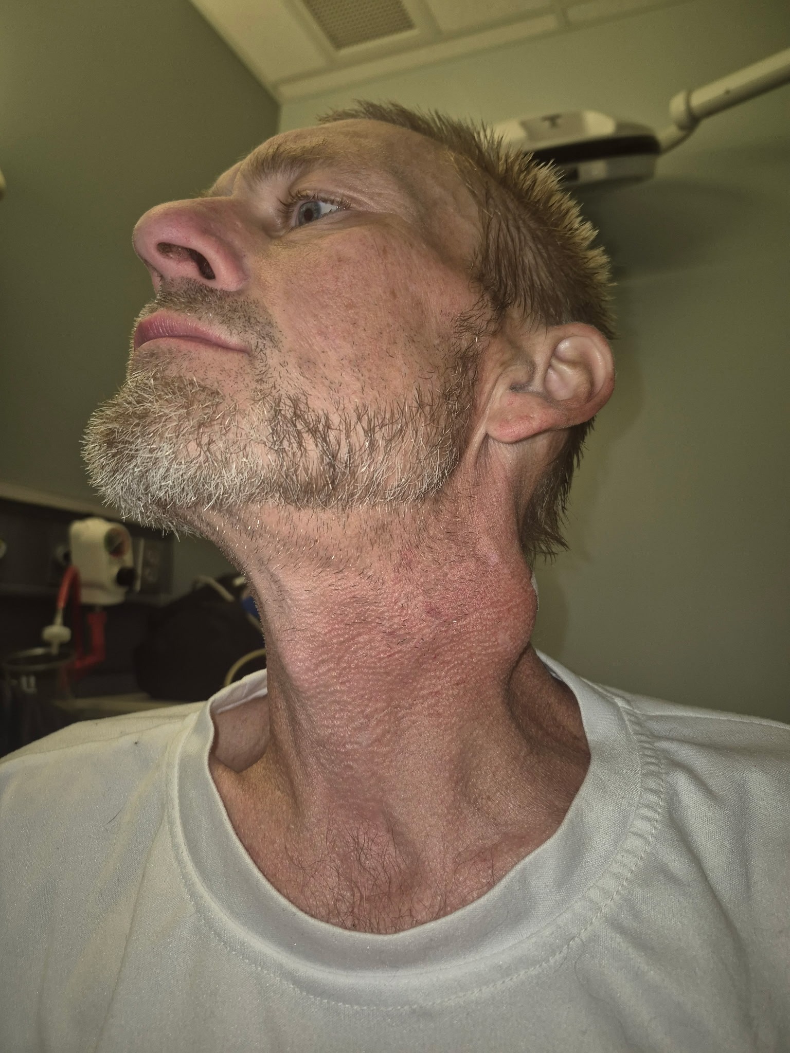 Fighting for Every Breath – Help Jeff & Rachel beat Cancer campaign photo, 2 of 5