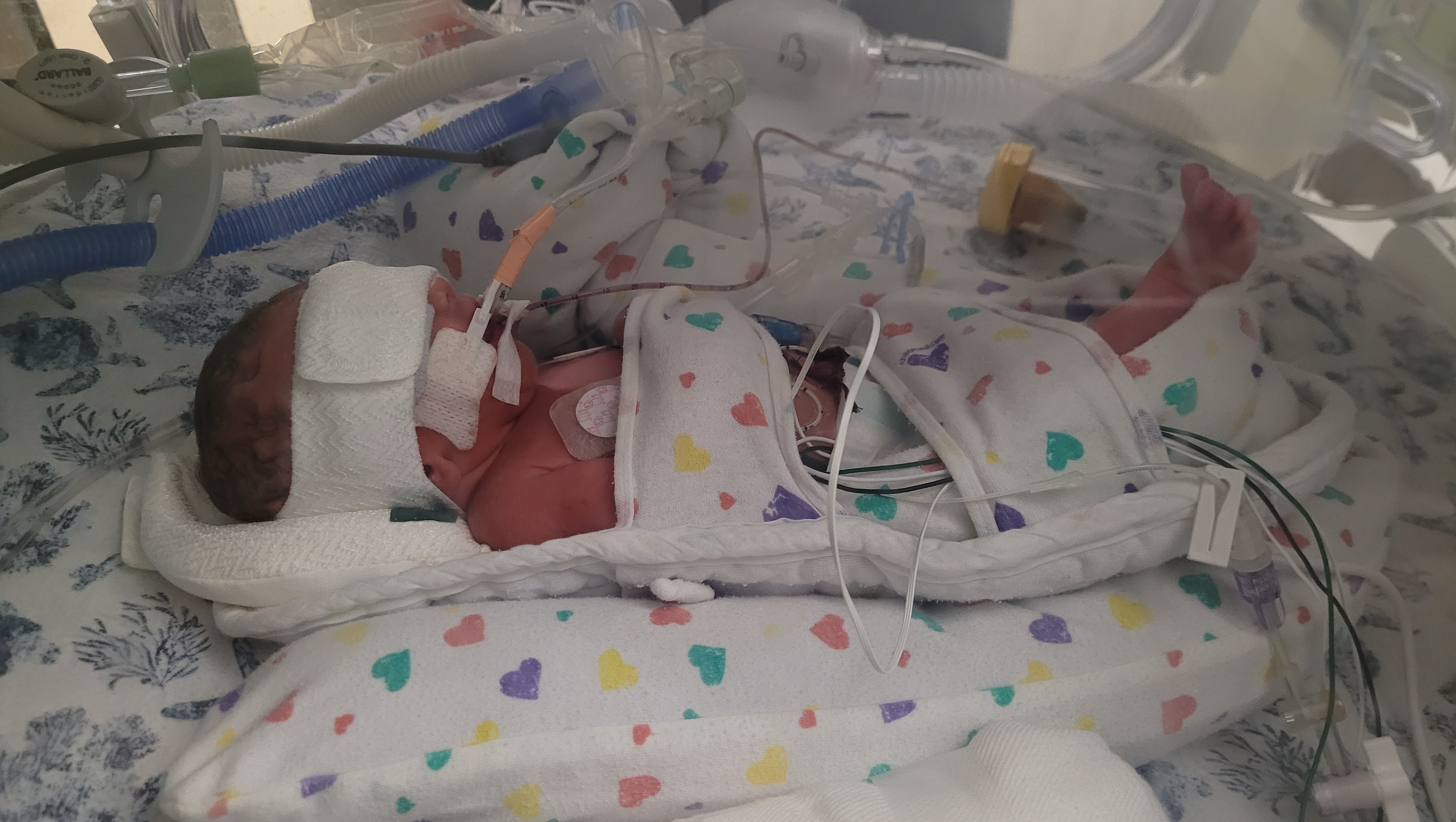 Fundraiser by kellie engle : Help For Baby Jaxson