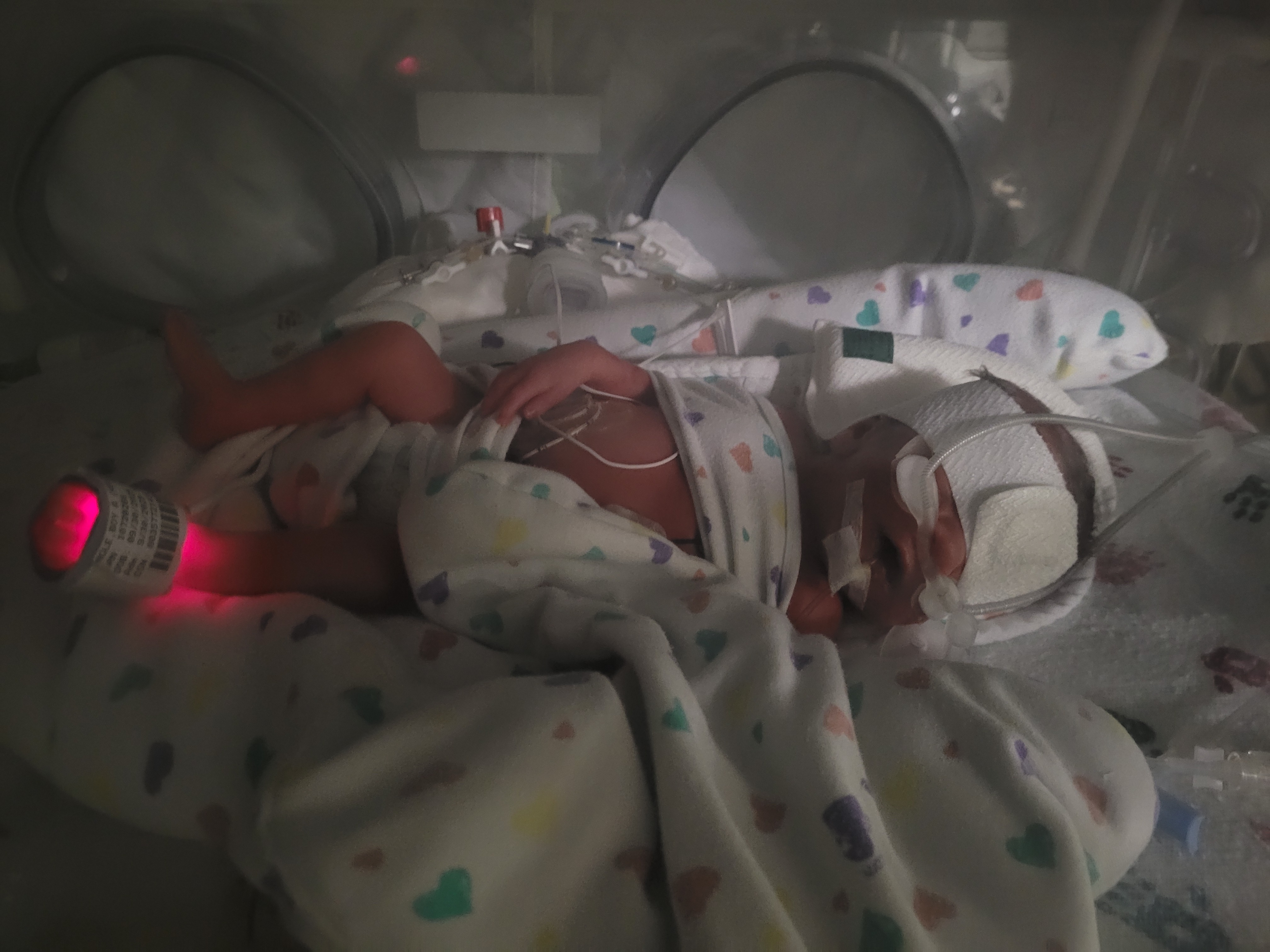 Help For Baby Jaxson campaign photo, 4 of 5