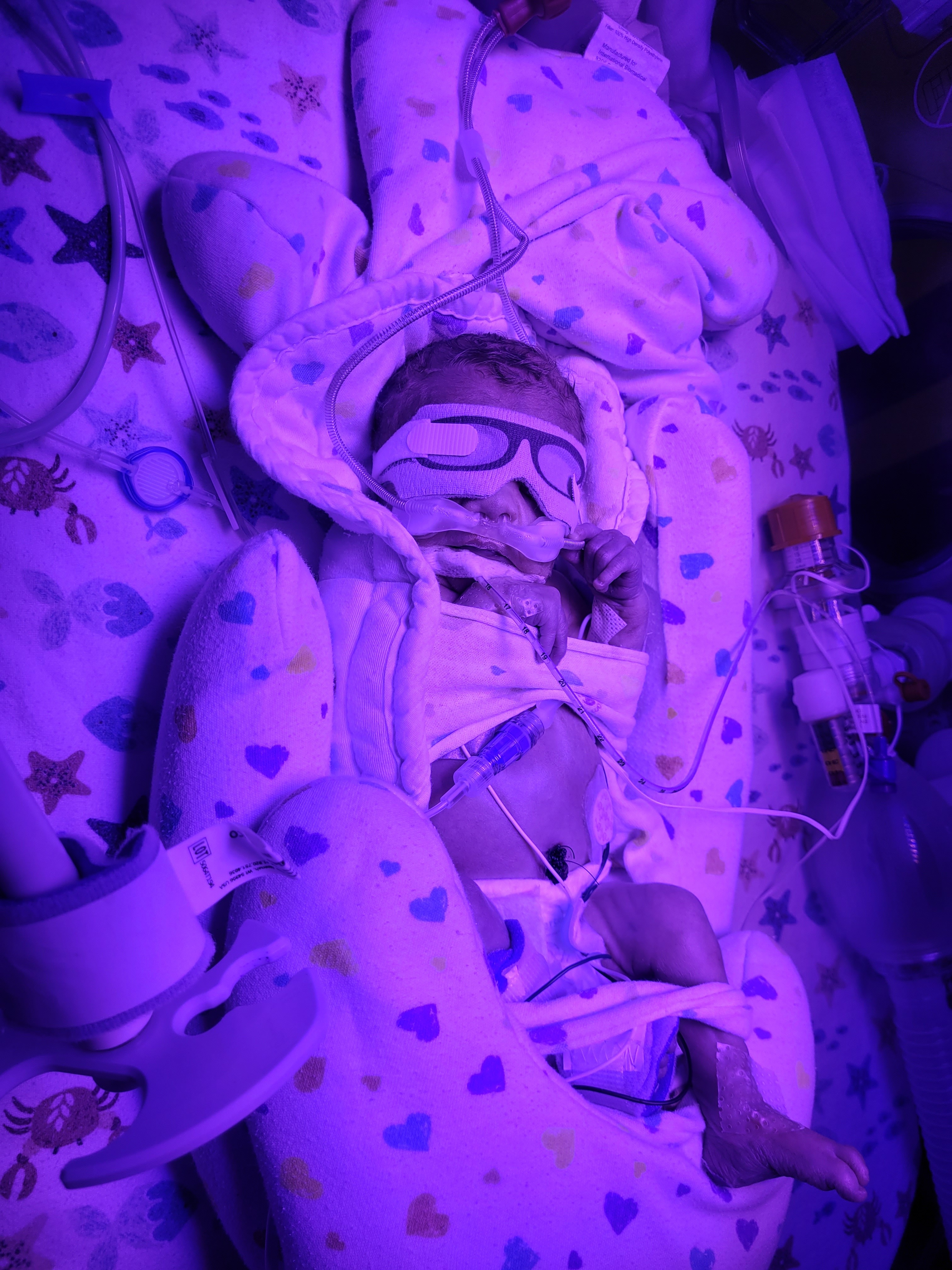 Help For Baby Jaxson campaign photo, 2 of 5