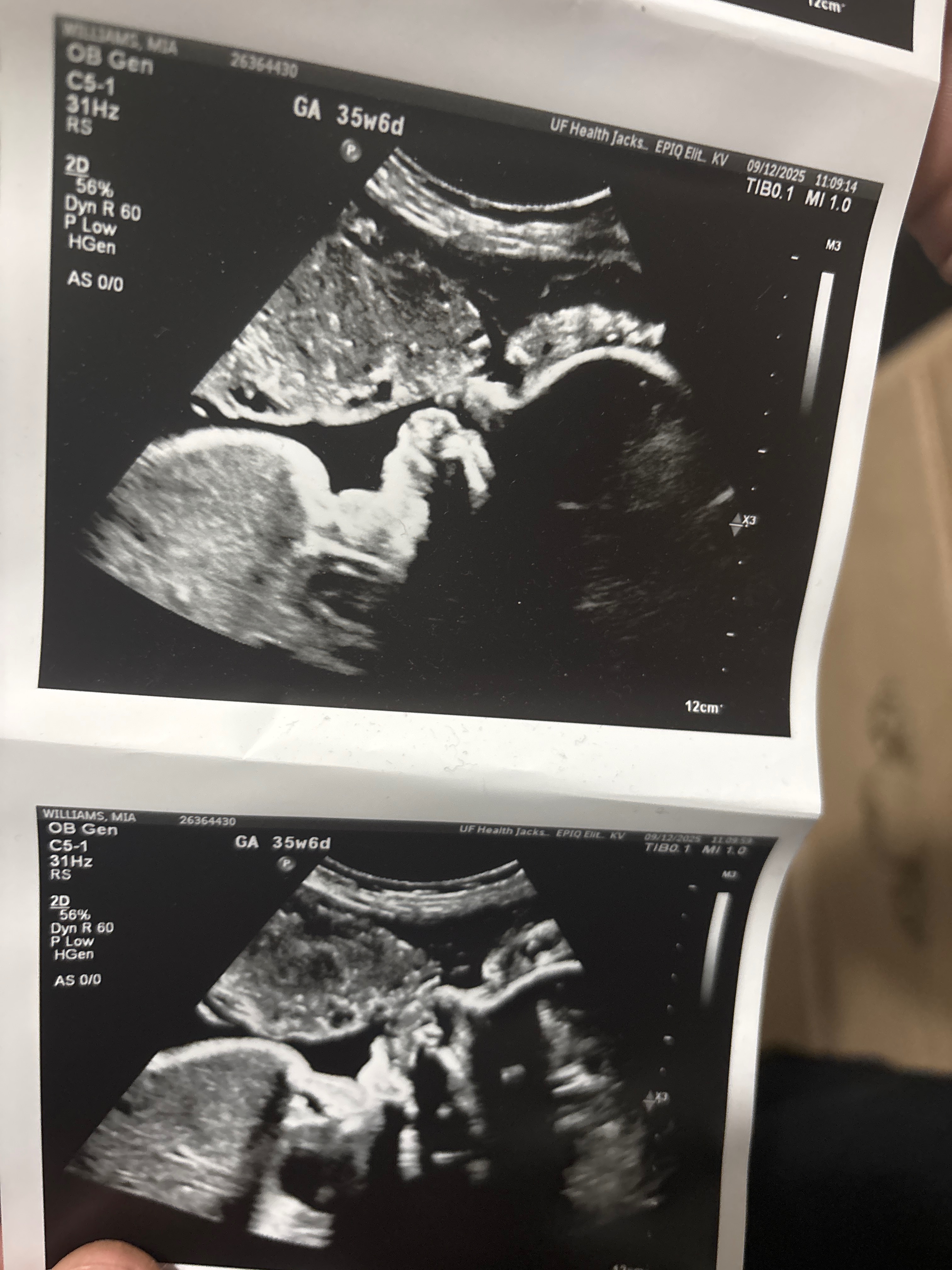 Support Mia's Baby Girl's Heart Surgery campaign photo, 2 of 5