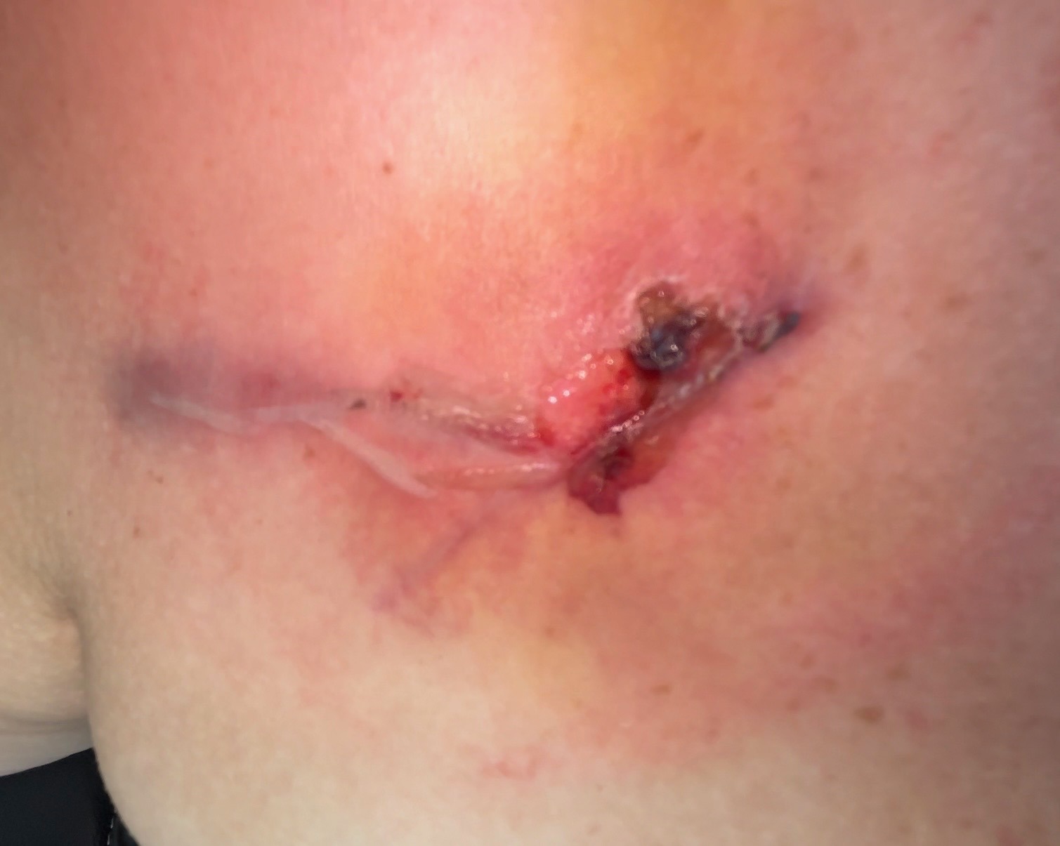 Support Stephanie's Heart Surgery Recovery campaign photo, 5 of 7